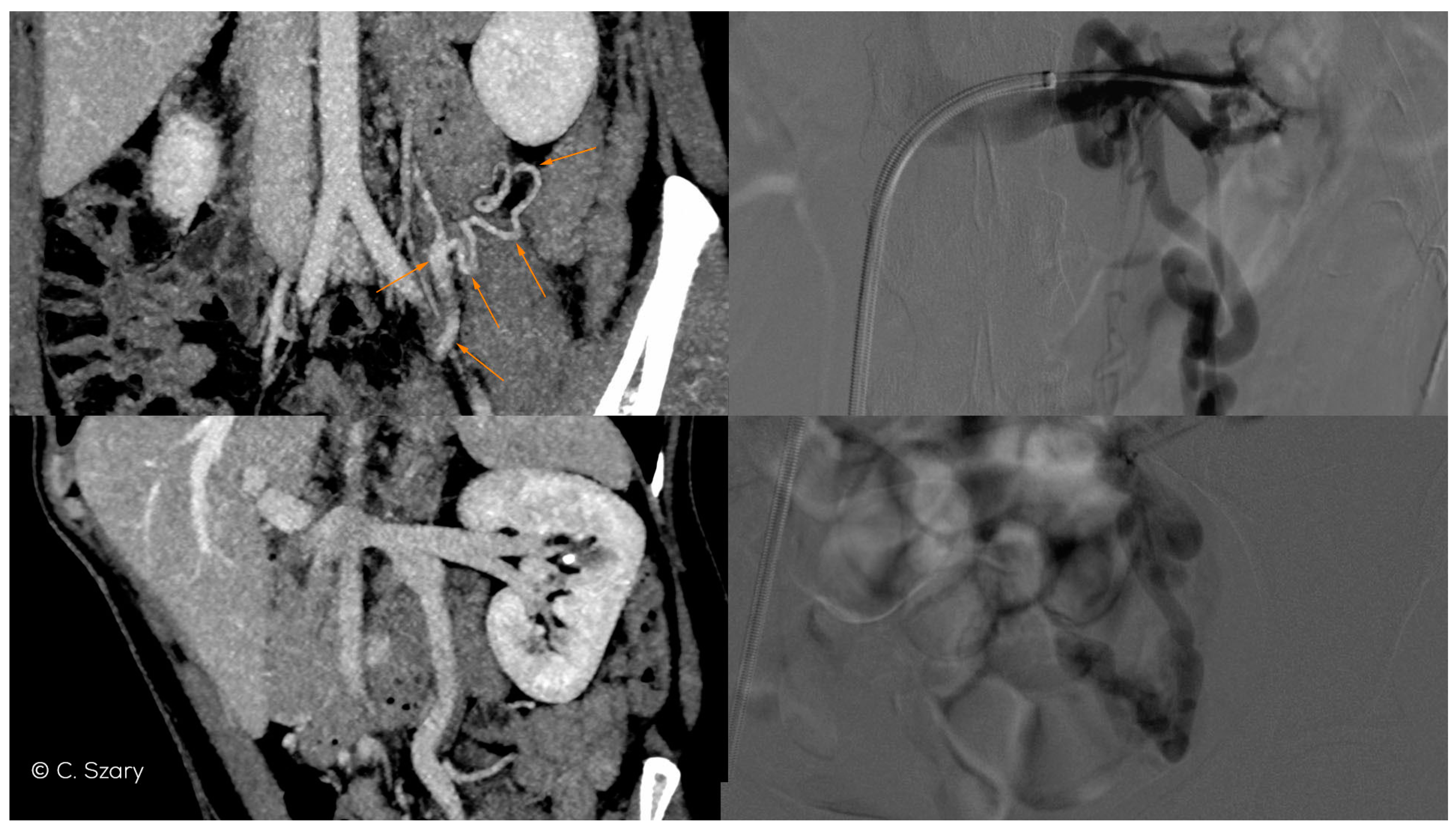 Jcm 10 00646 g006 Jcm 10 00646 g006
