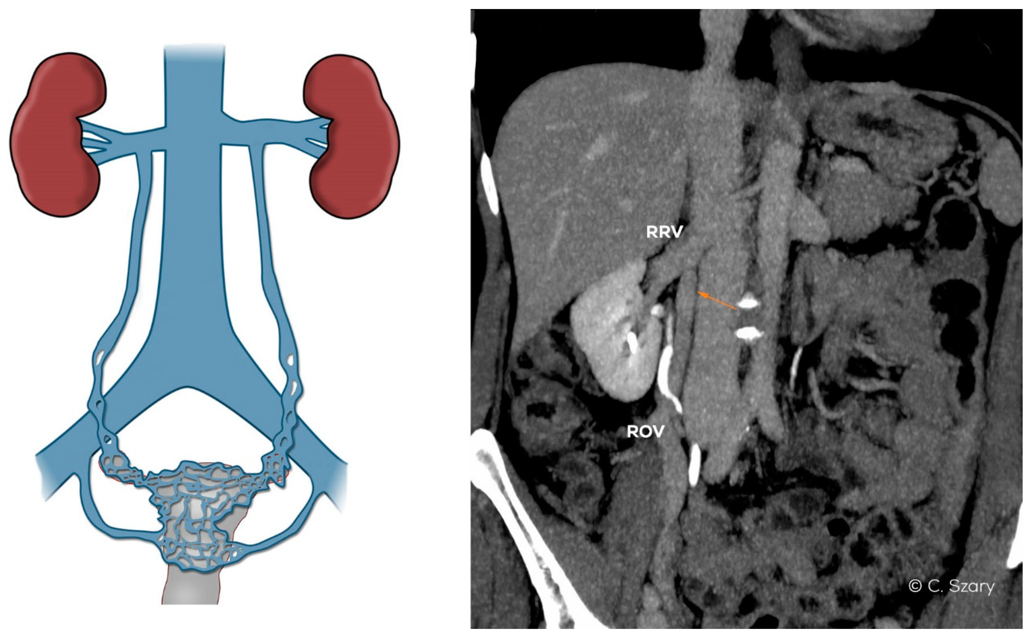 Jcm 10 00646 g007 Jcm 10 00646 g007