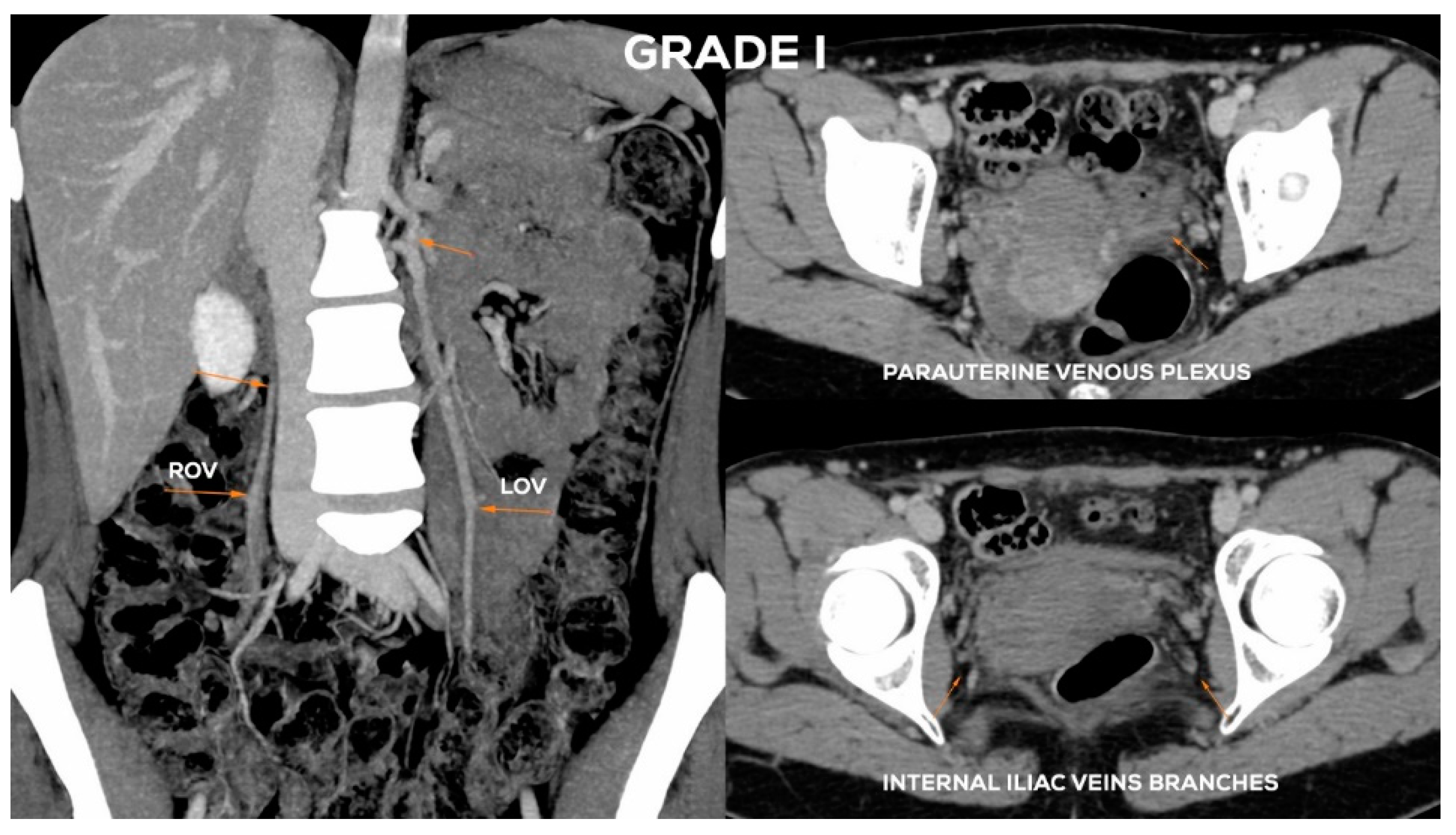 Jcm 10 00646 g009 Jcm 10 00646 g009