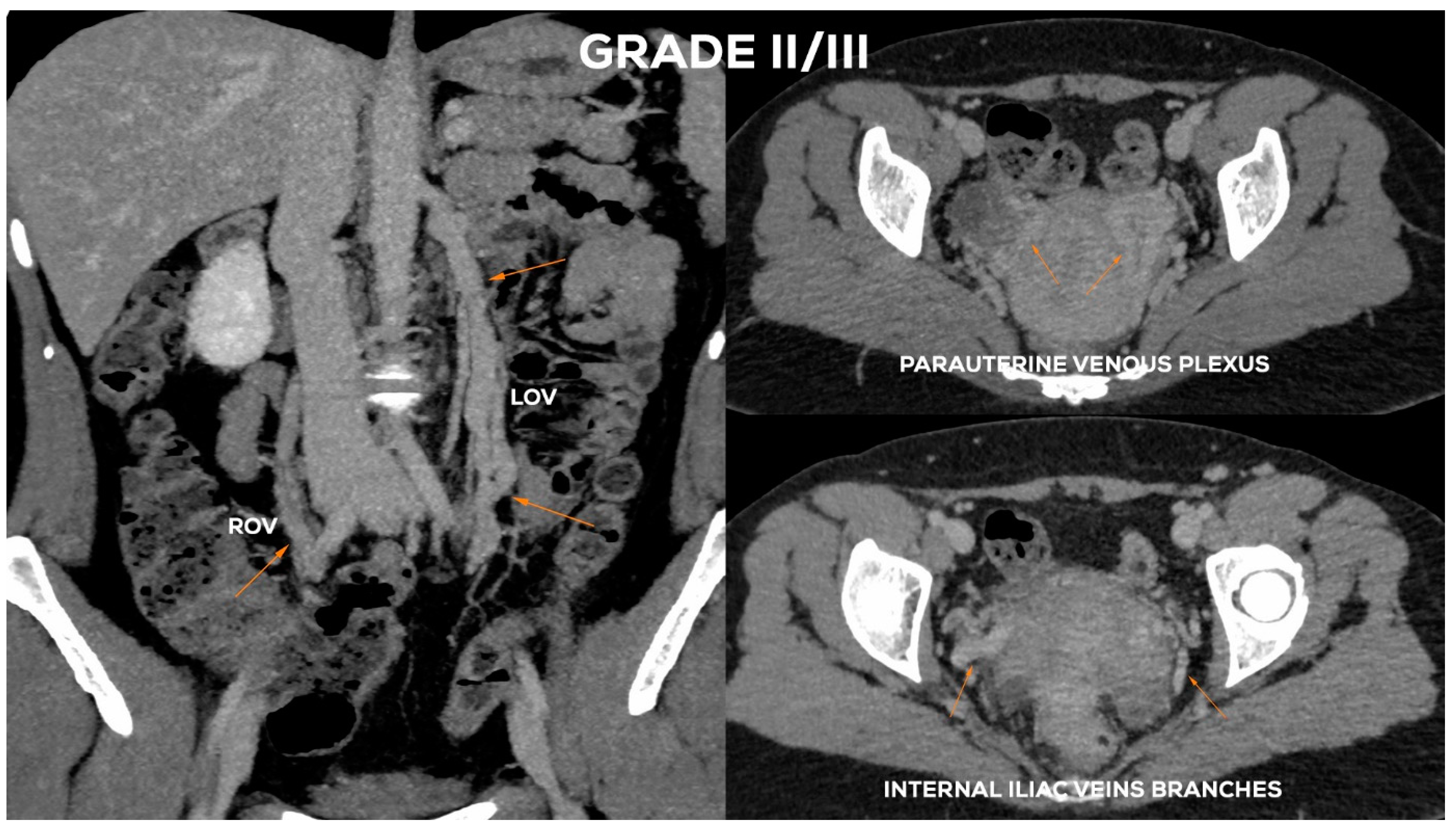 Jcm 10 00646 g013 Jcm 10 00646 g013