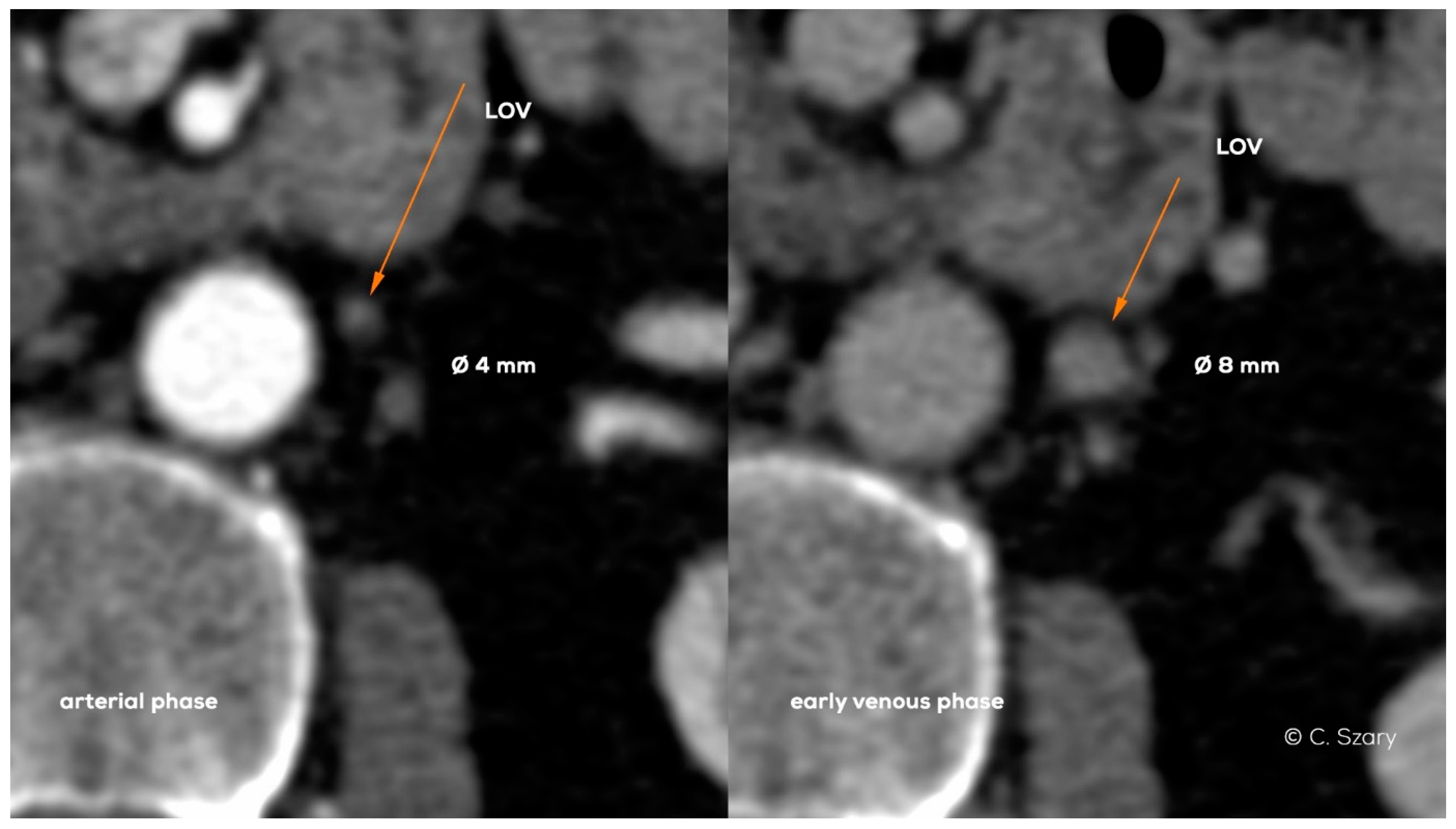 Jcm 10 00646 g019 Jcm 10 00646 g019