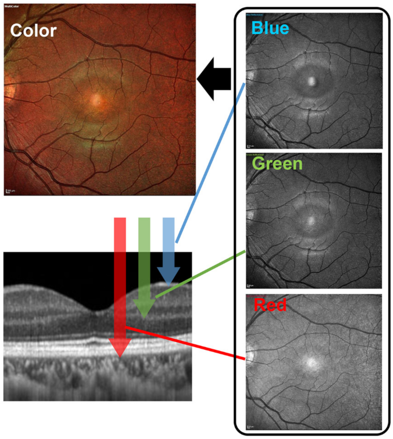 Jcm 10 00718 g003 Jcm 10 00718 g003
