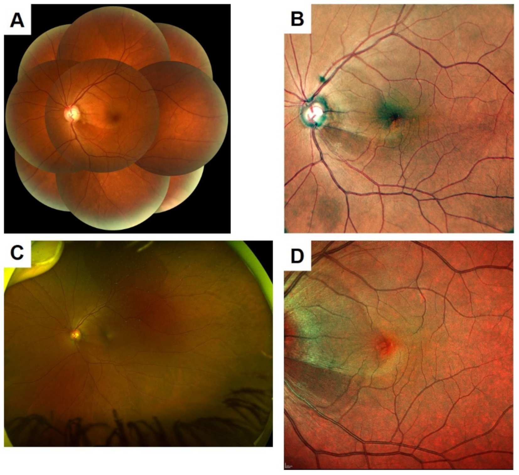 Jcm 10 00718 g004 Jcm 10 00718 g004