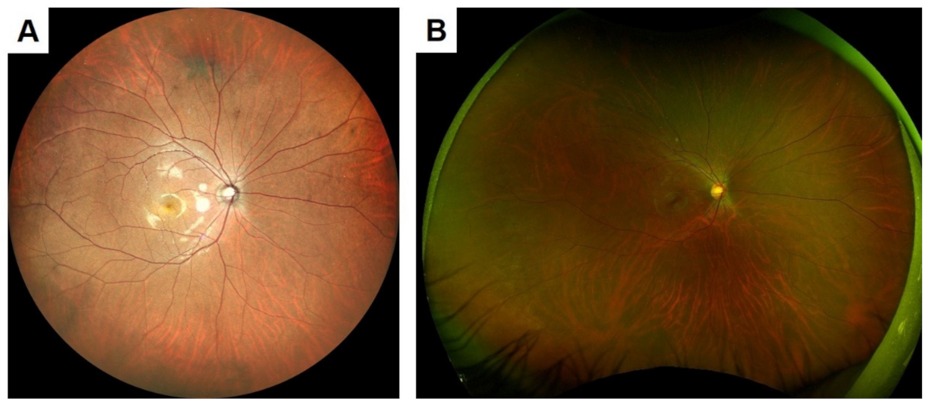 Jcm 10 00718 g005 Jcm 10 00718 g005