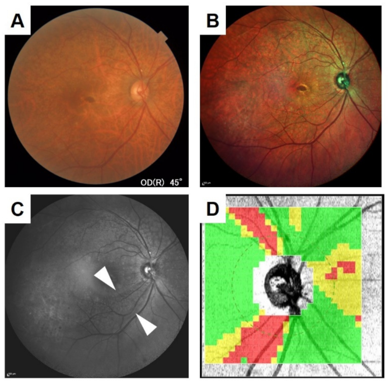 Jcm 10 00718 g006 Jcm 10 00718 g006