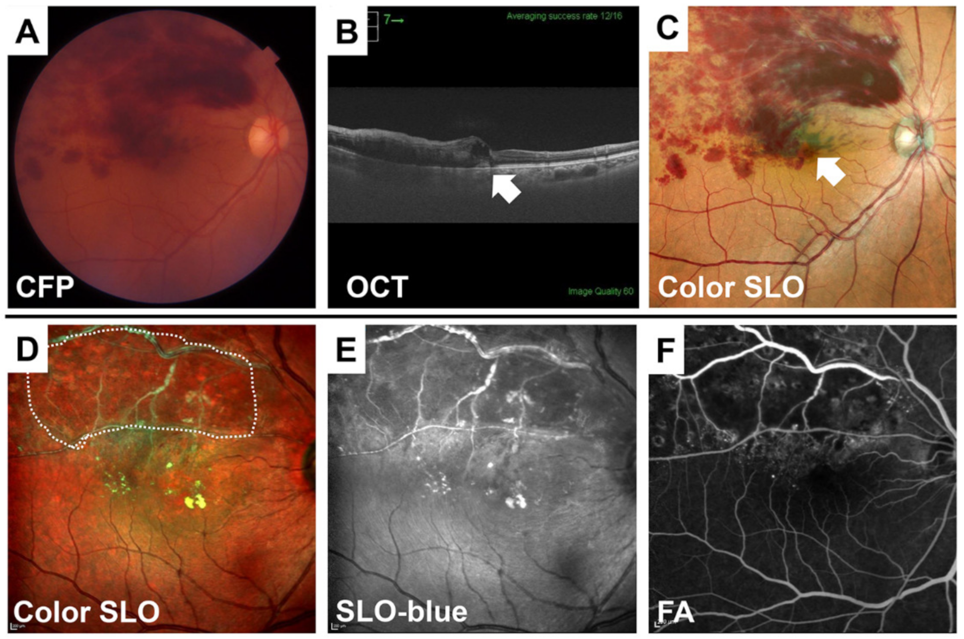 Jcm 10 00718 g009 Jcm 10 00718 g009