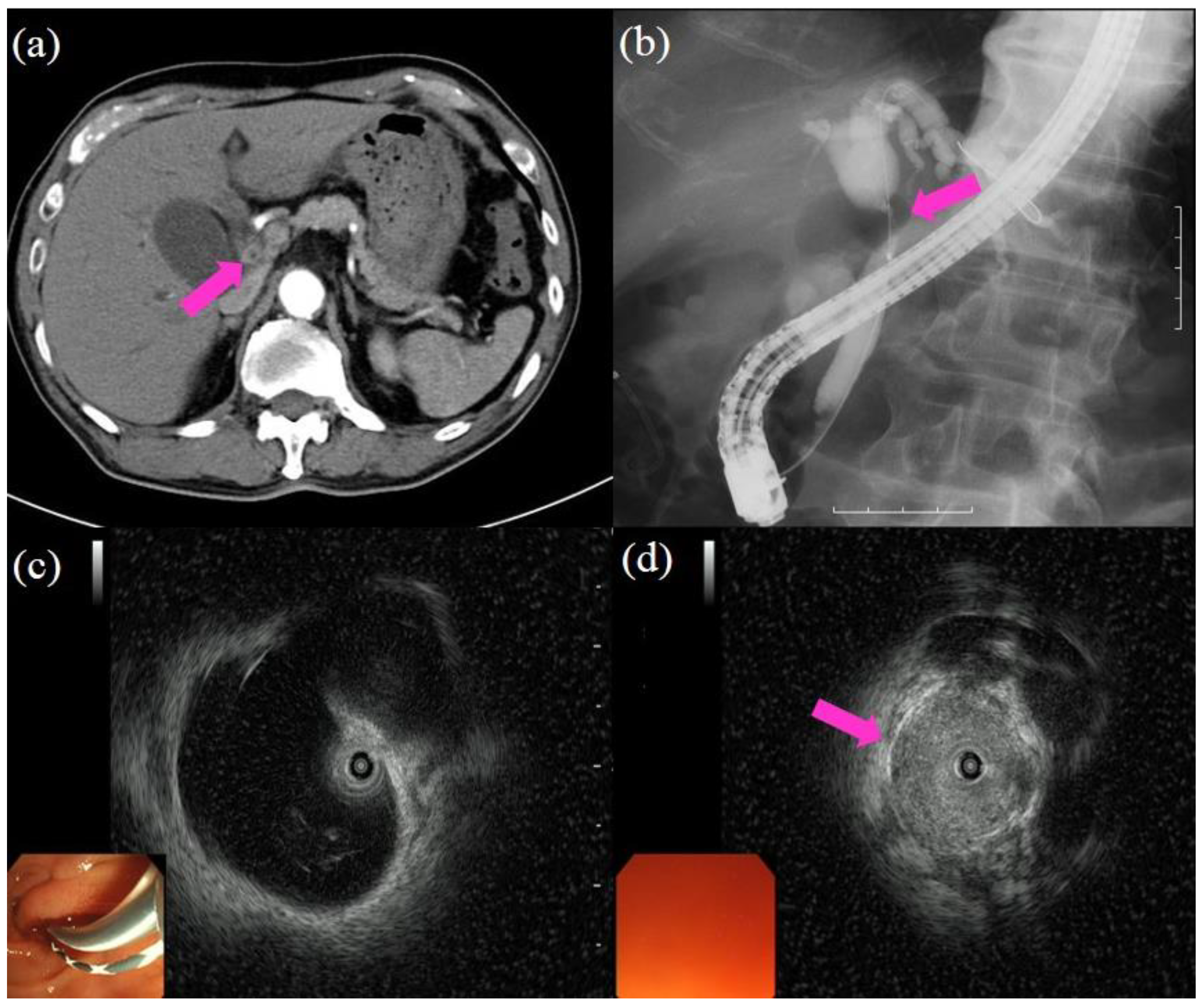 Jcm 10 01048 g001 Jcm 10 01048 g001