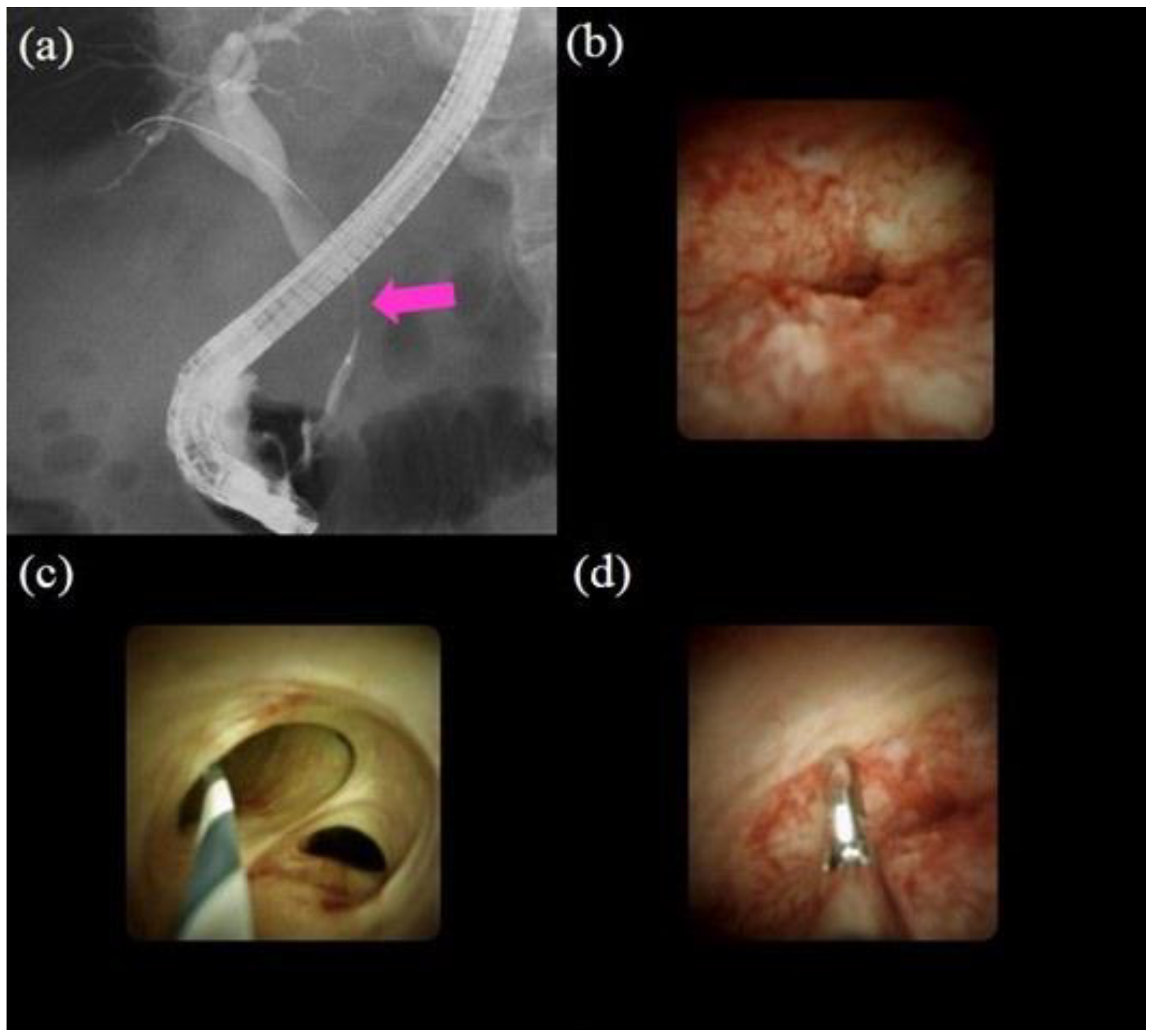 Jcm 10 01048 g003 Jcm 10 01048 g003