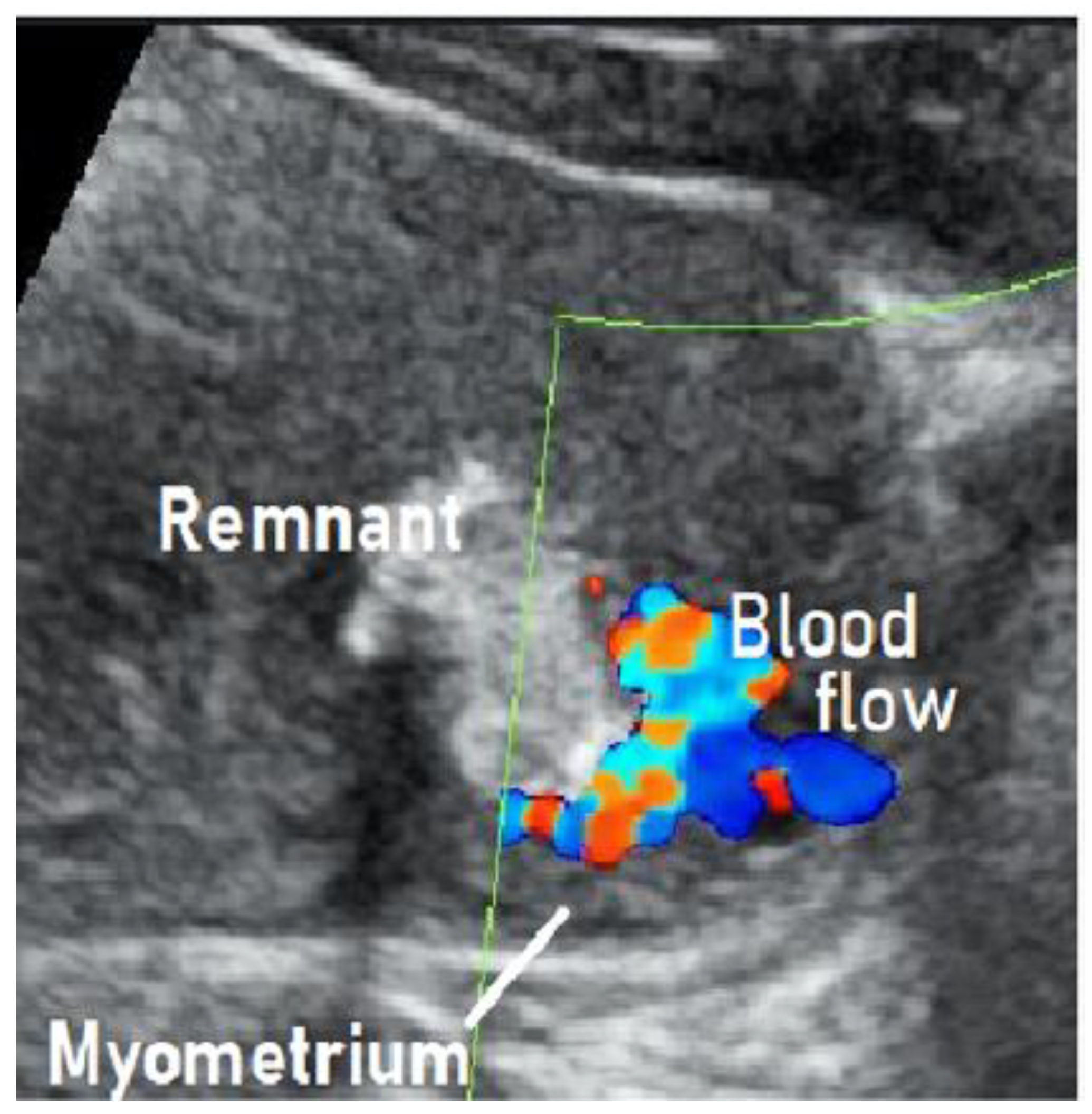 Jcm 10 01084 g001 Jcm 10 01084 g001