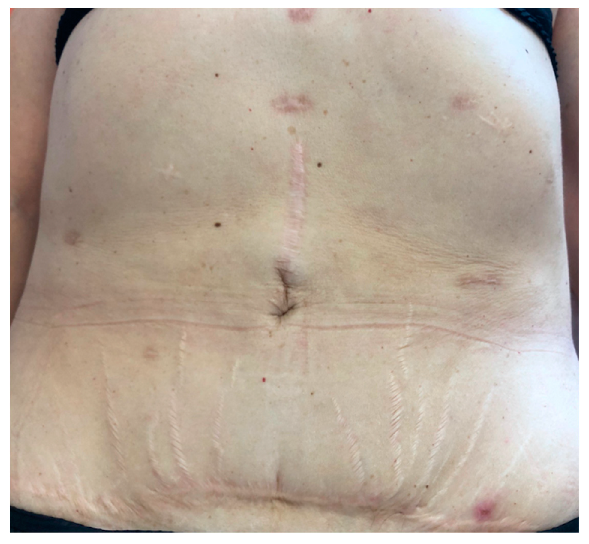 Jcm 10 01292 g001 Jcm 10 01292 g001