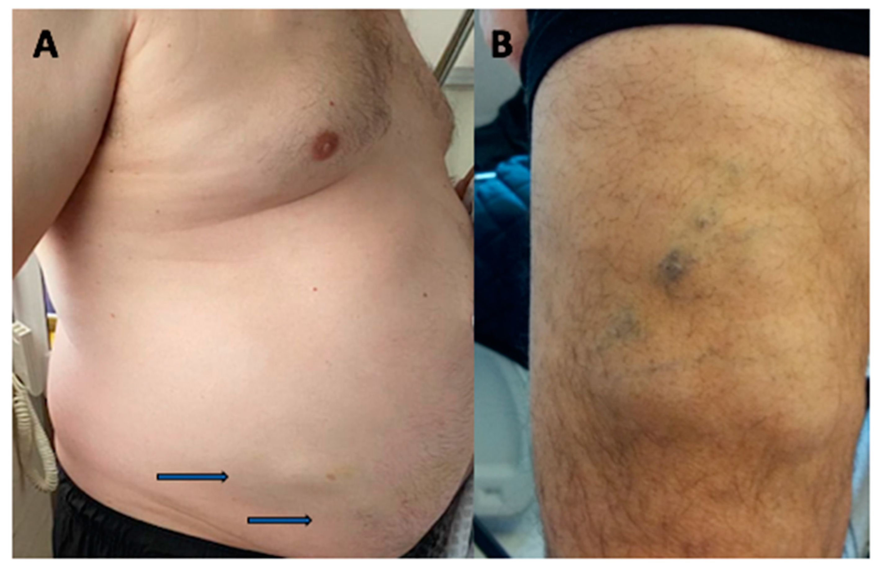 Jcm 10 01292 g002 Jcm 10 01292 g002