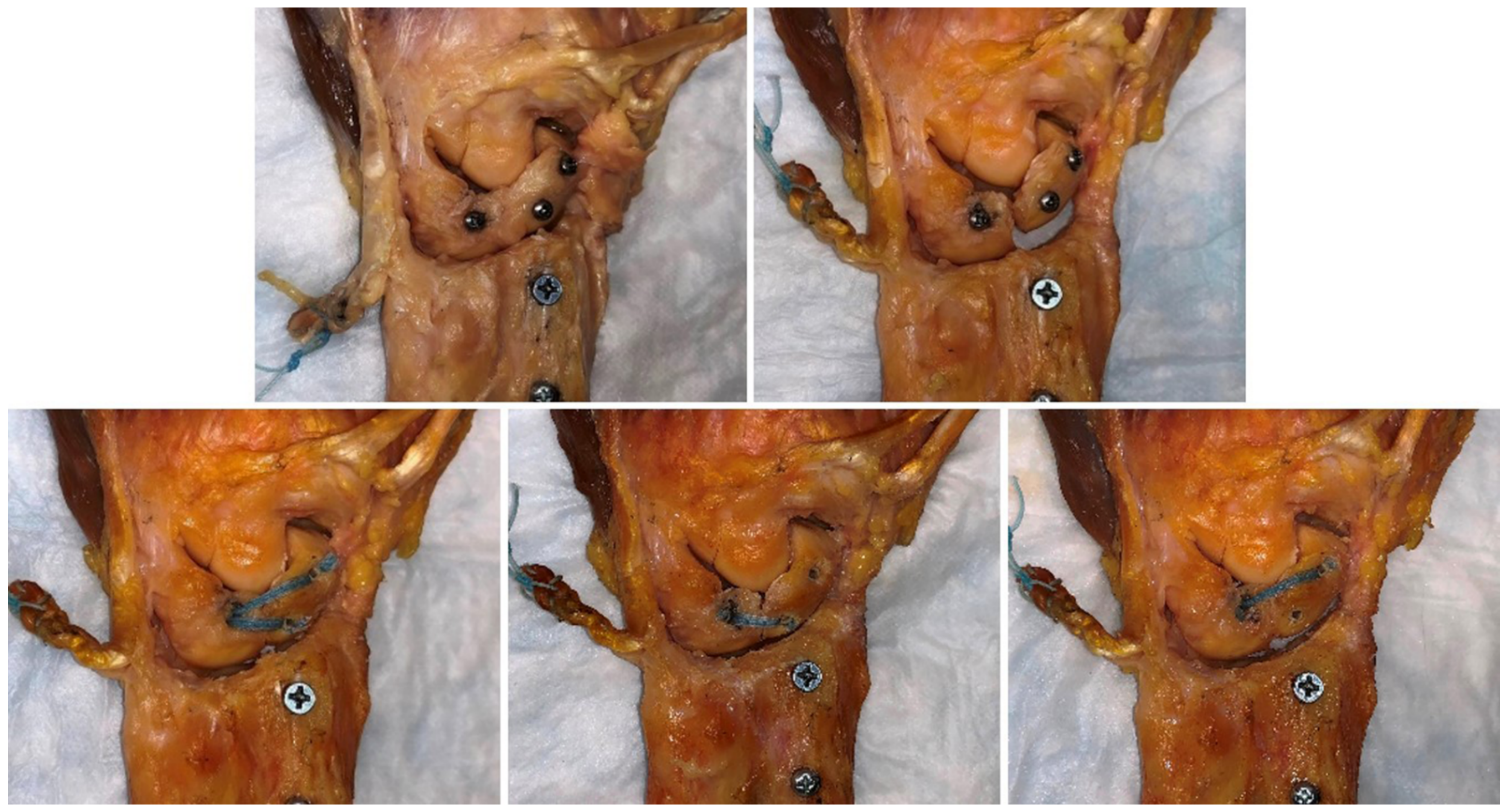 Jcm 10 01482 g004 Jcm 10 01482 g004