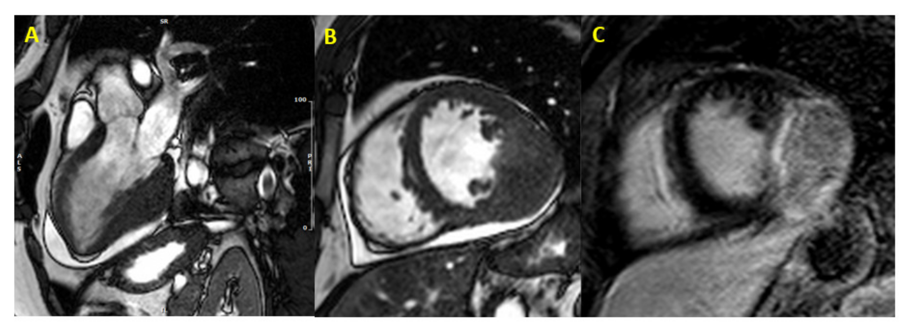 Jcm 10 01683 g002 Jcm 10 01683 g002