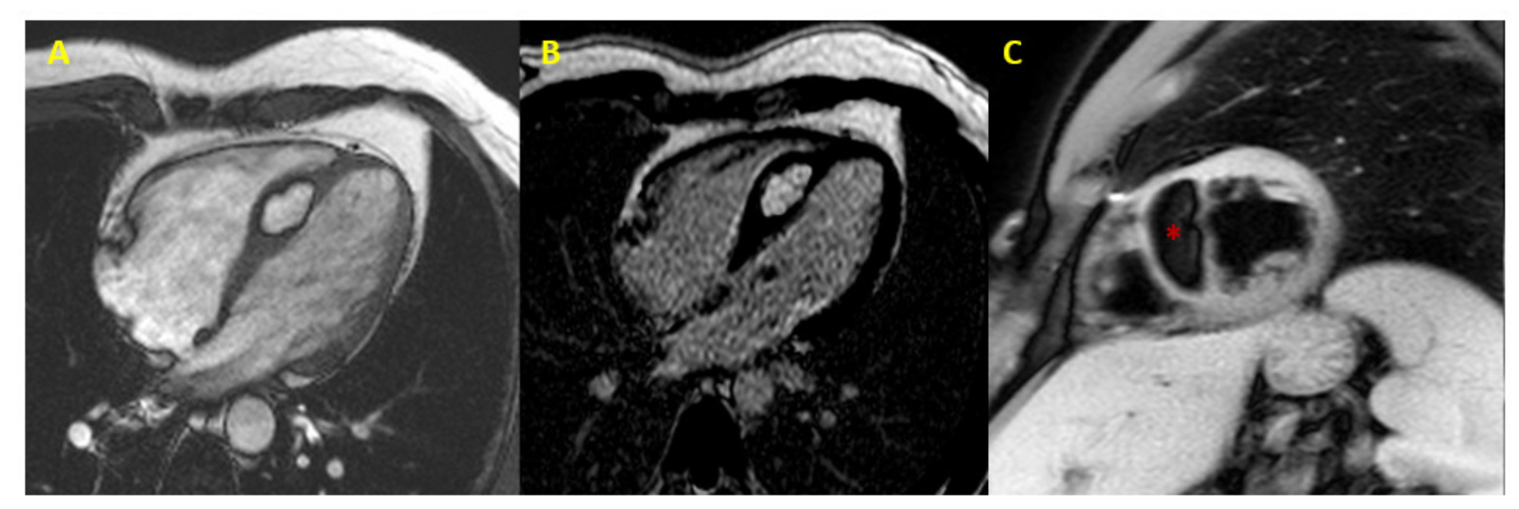 Jcm 10 01683 g003 Jcm 10 01683 g003