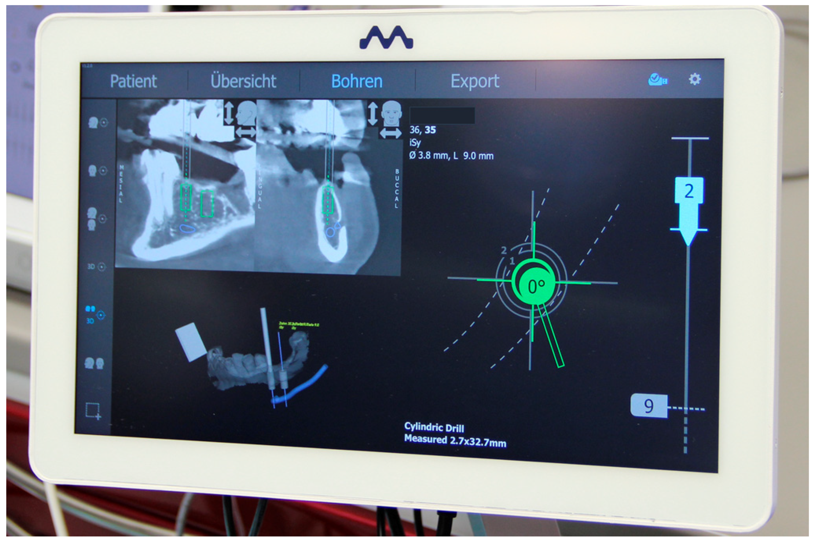Jcm 10 01808 g005 Jcm 10 01808 g005