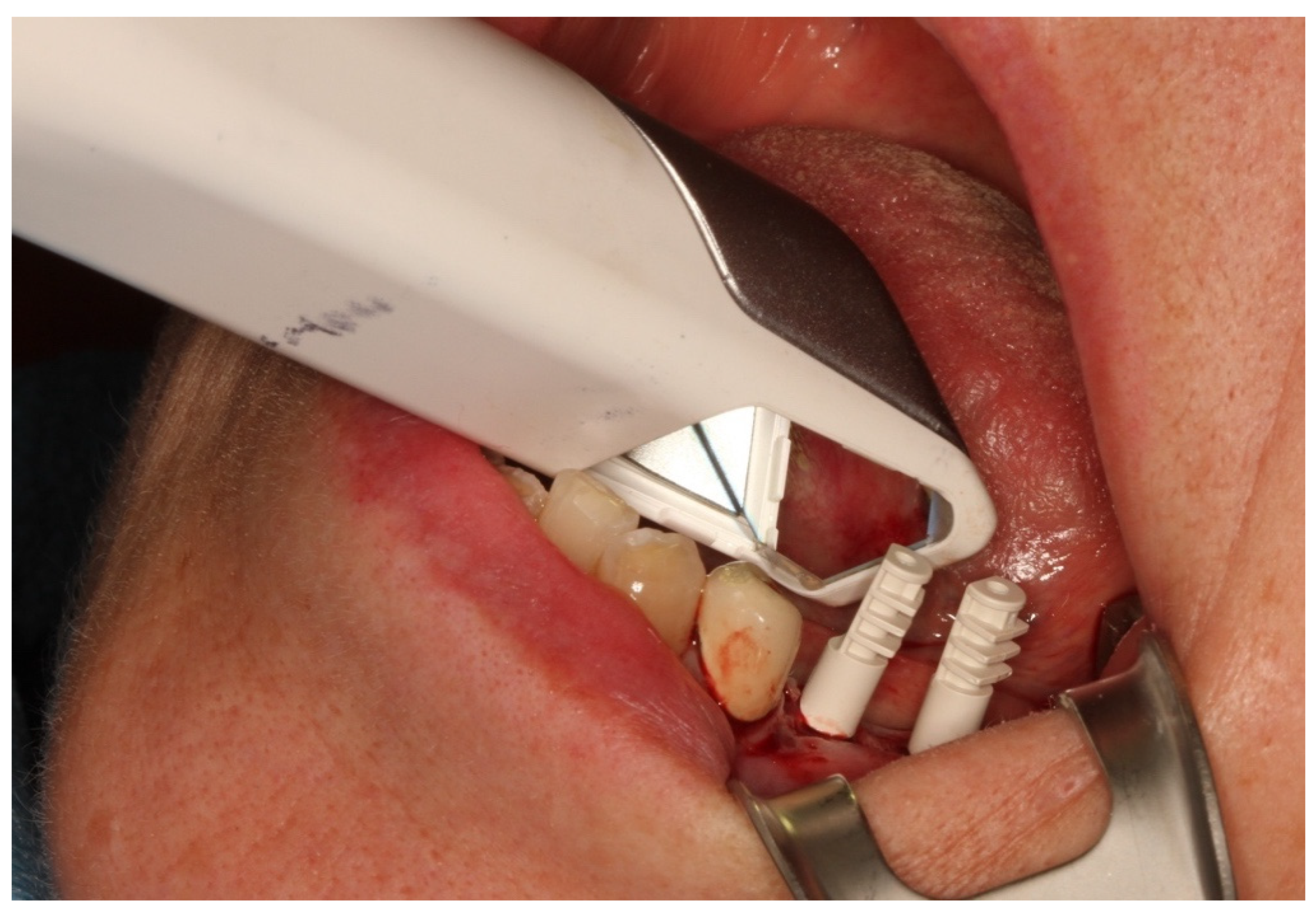 Jcm 10 01808 g007 Jcm 10 01808 g007