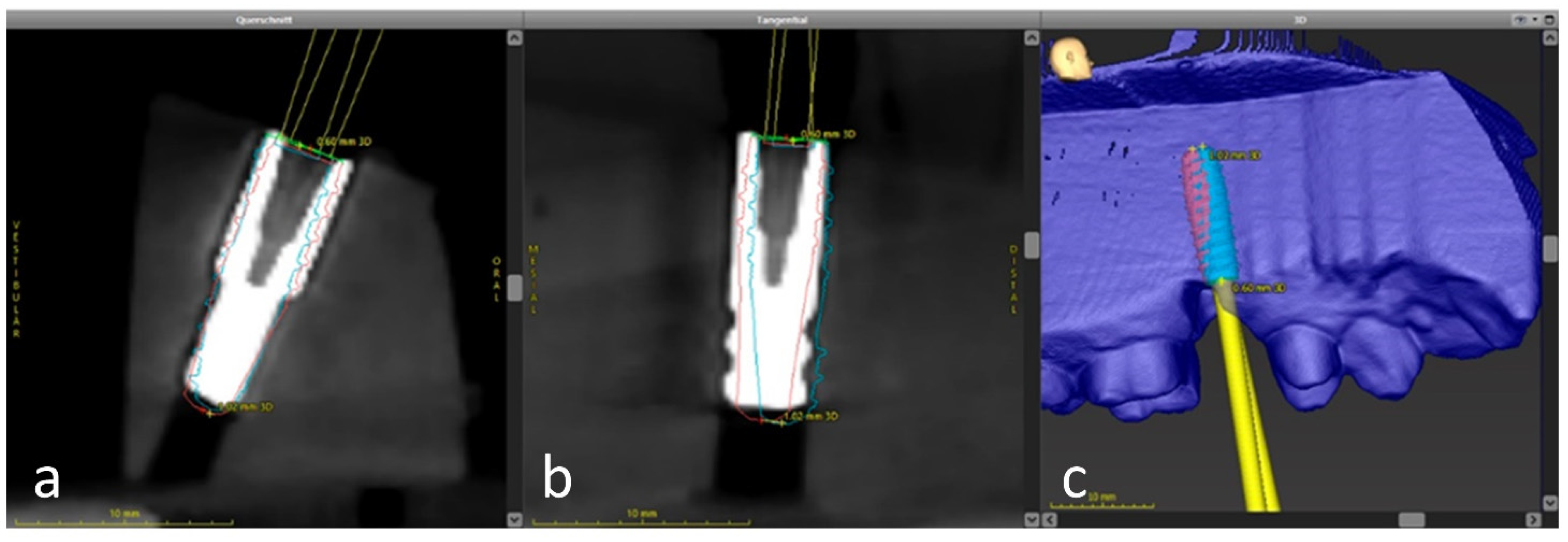 Jcm 10 01808 g008 Jcm 10 01808 g008