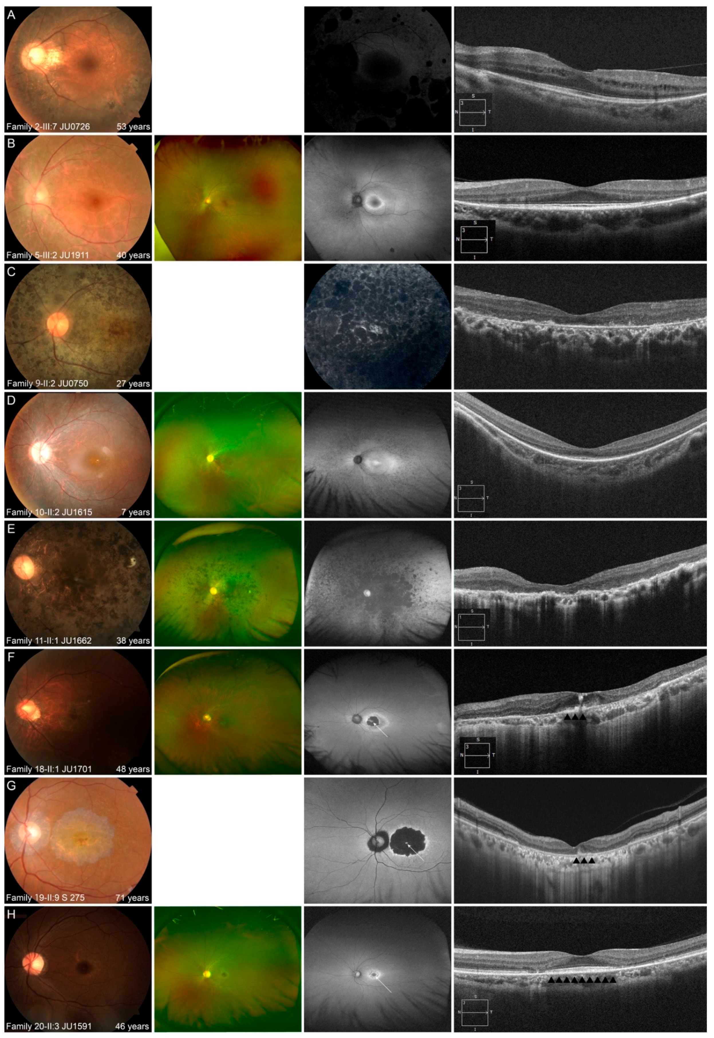 Jcm 10 02265 g005 Jcm 10 02265 g005