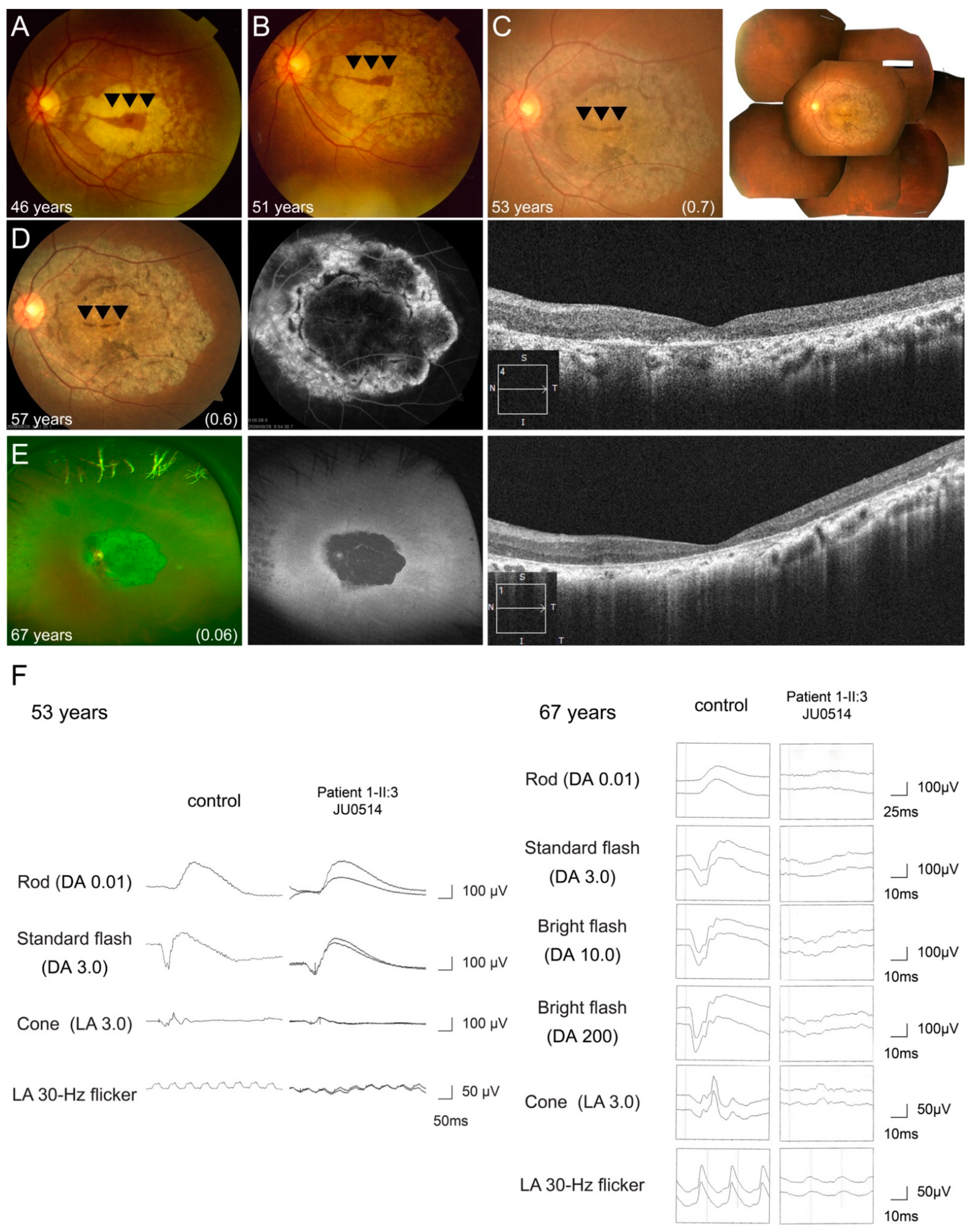 Jcm 10 02265 g006 Jcm 10 02265 g006