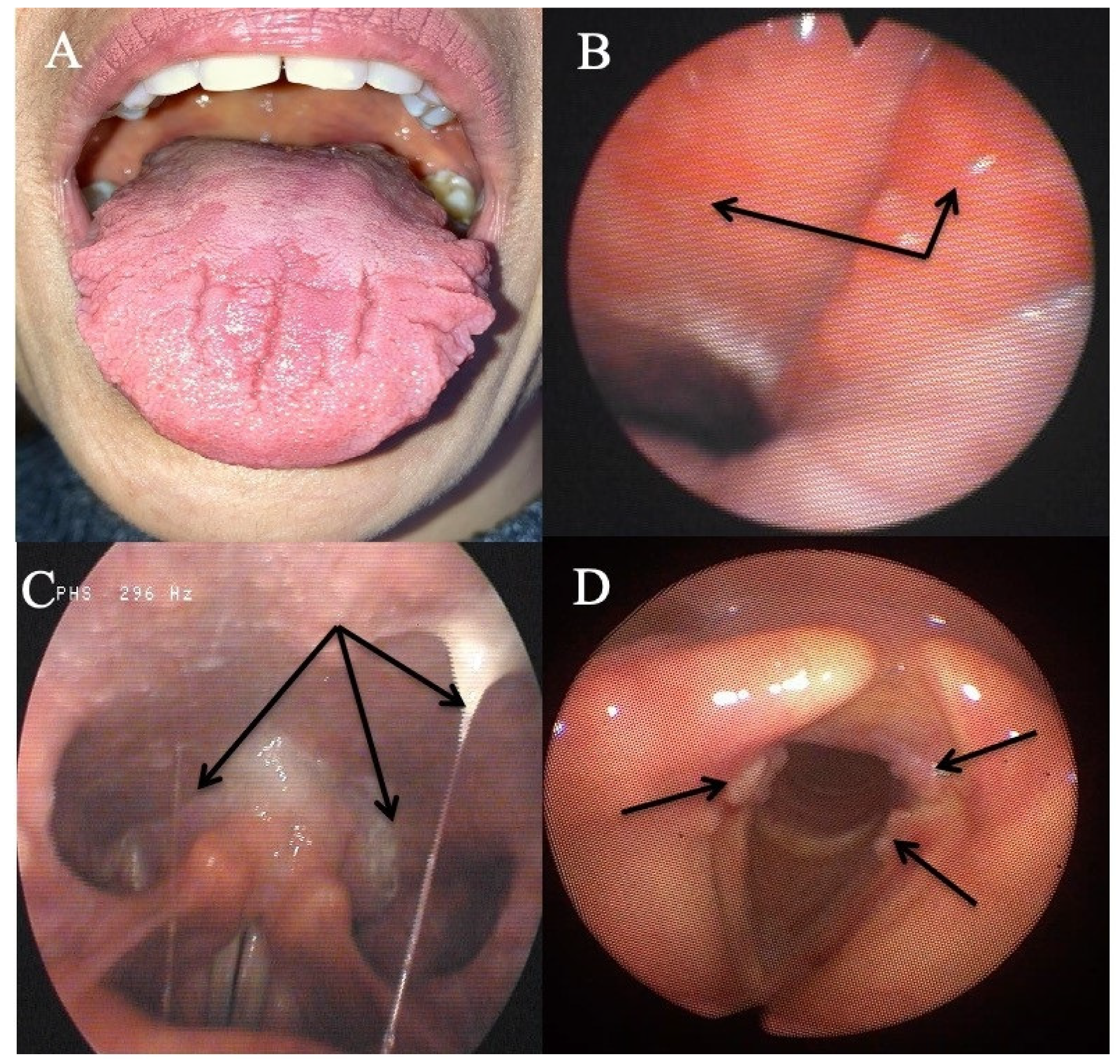 Jcm 10 02439 g003 Jcm 10 02439 g003