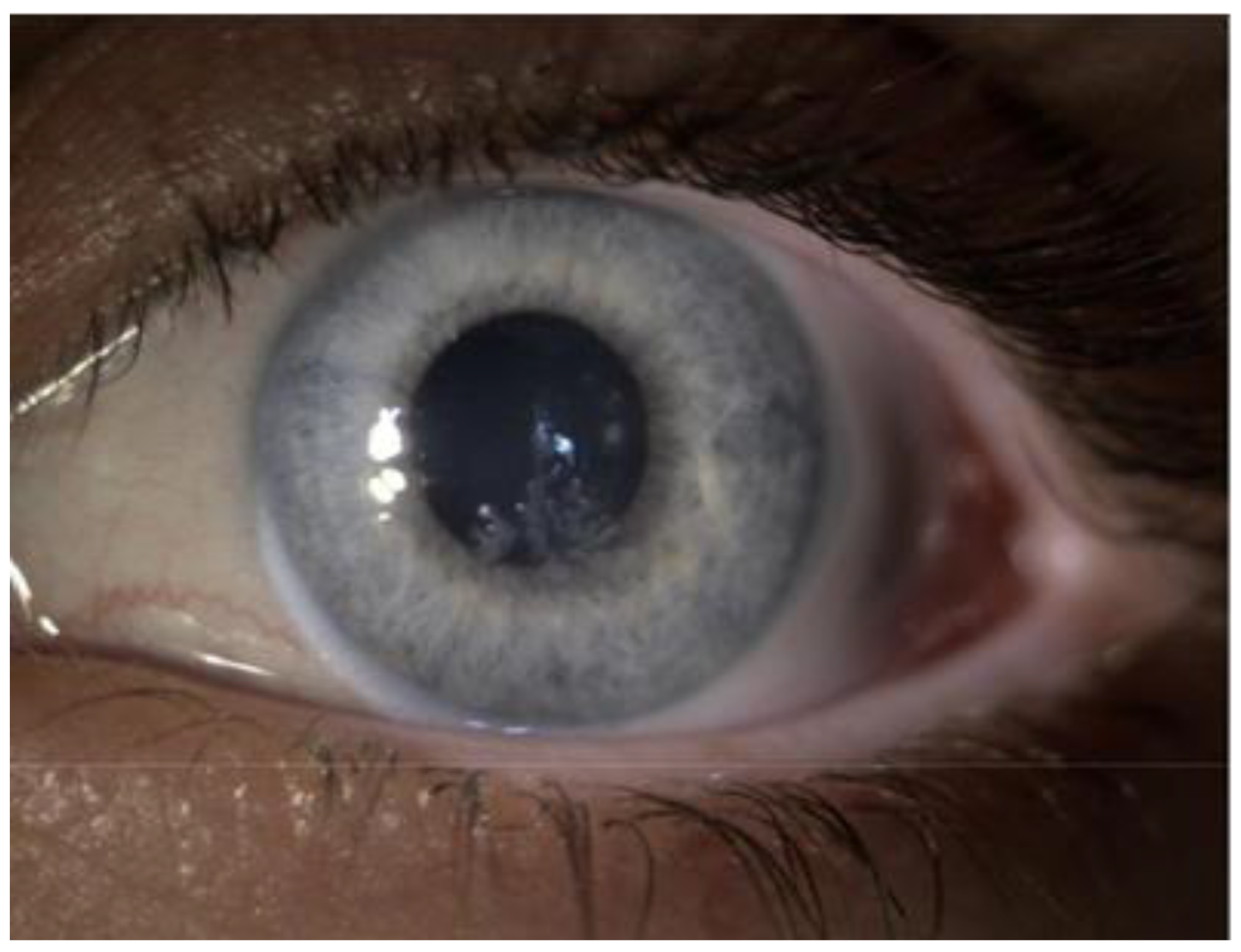 Jcm 10 02684 g002 Jcm 10 02684 g002