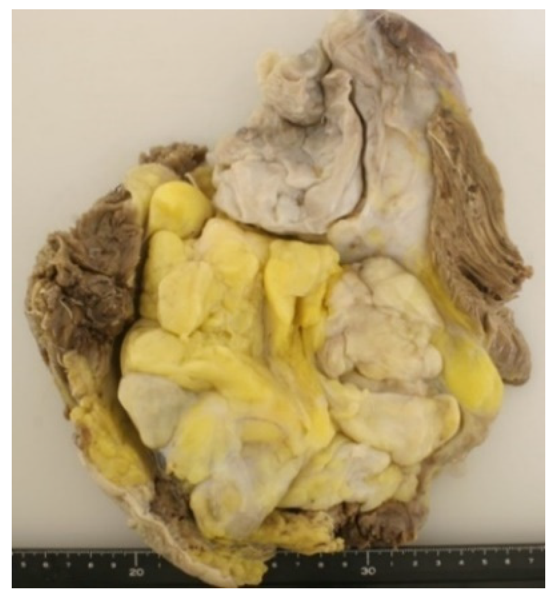 Jcm 10 03230 g003 Jcm 10 03230 g003