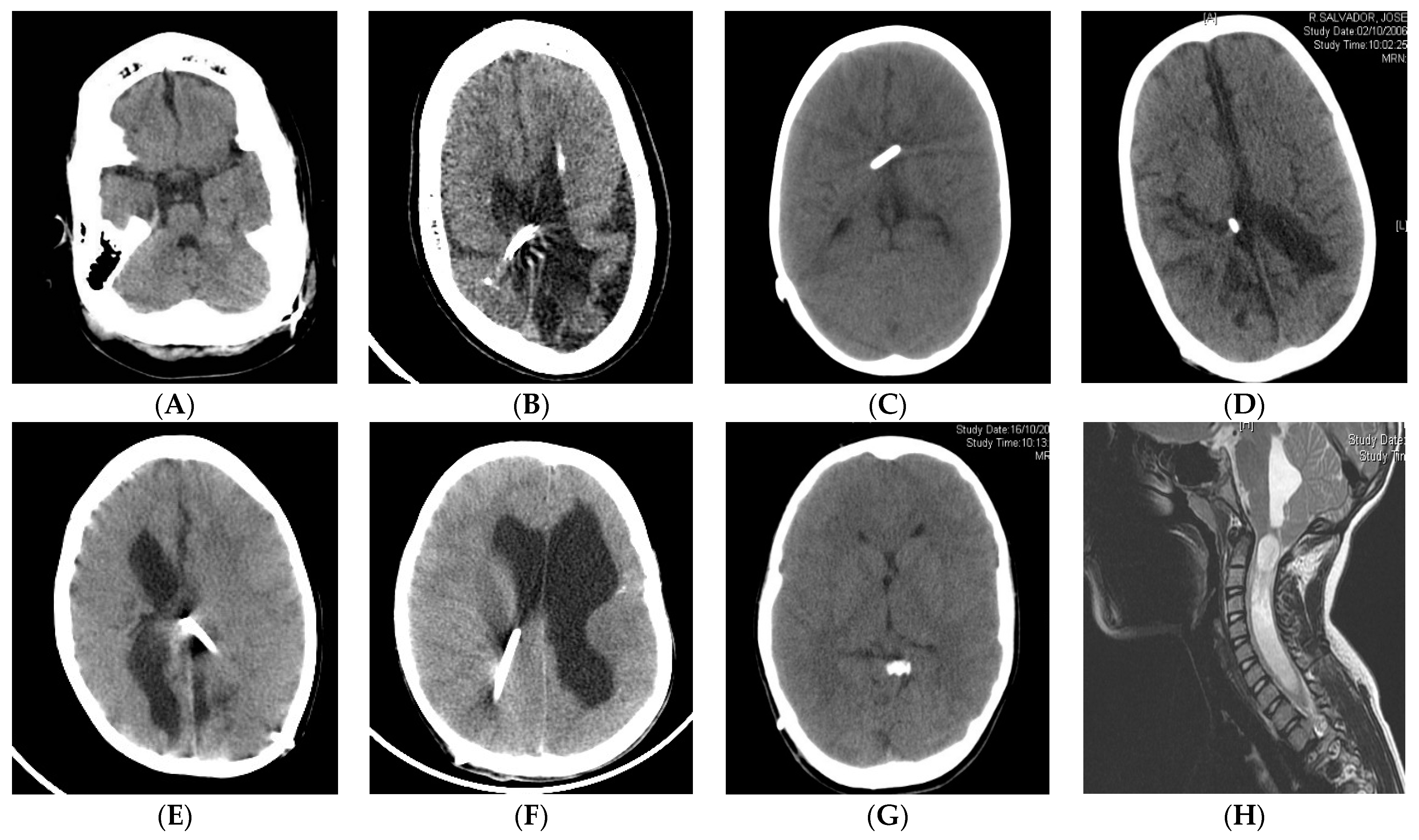 Jcm 10 03620 g001 Jcm 10 03620 g001