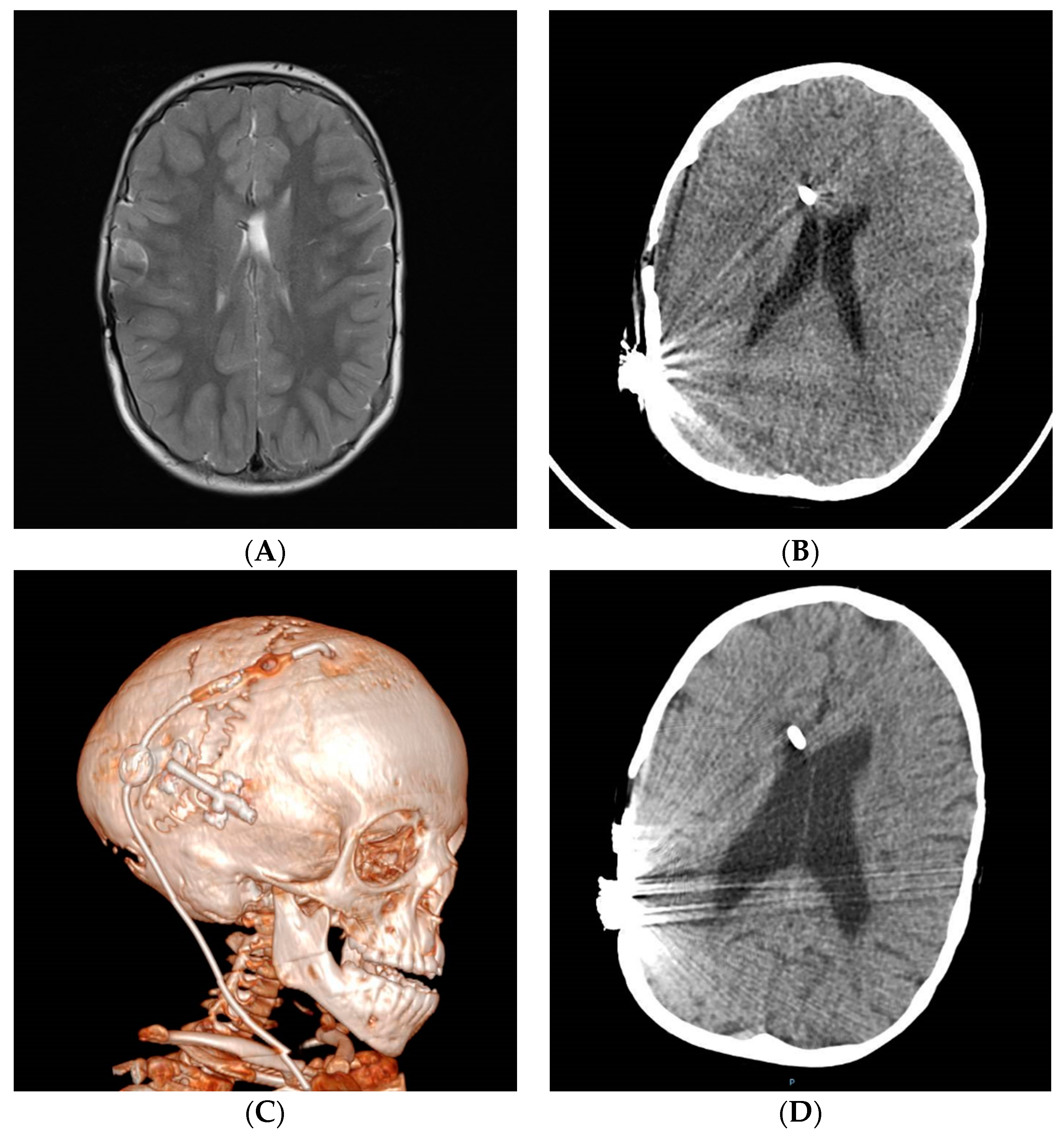 Jcm 10 03620 g005 Jcm 10 03620 g005