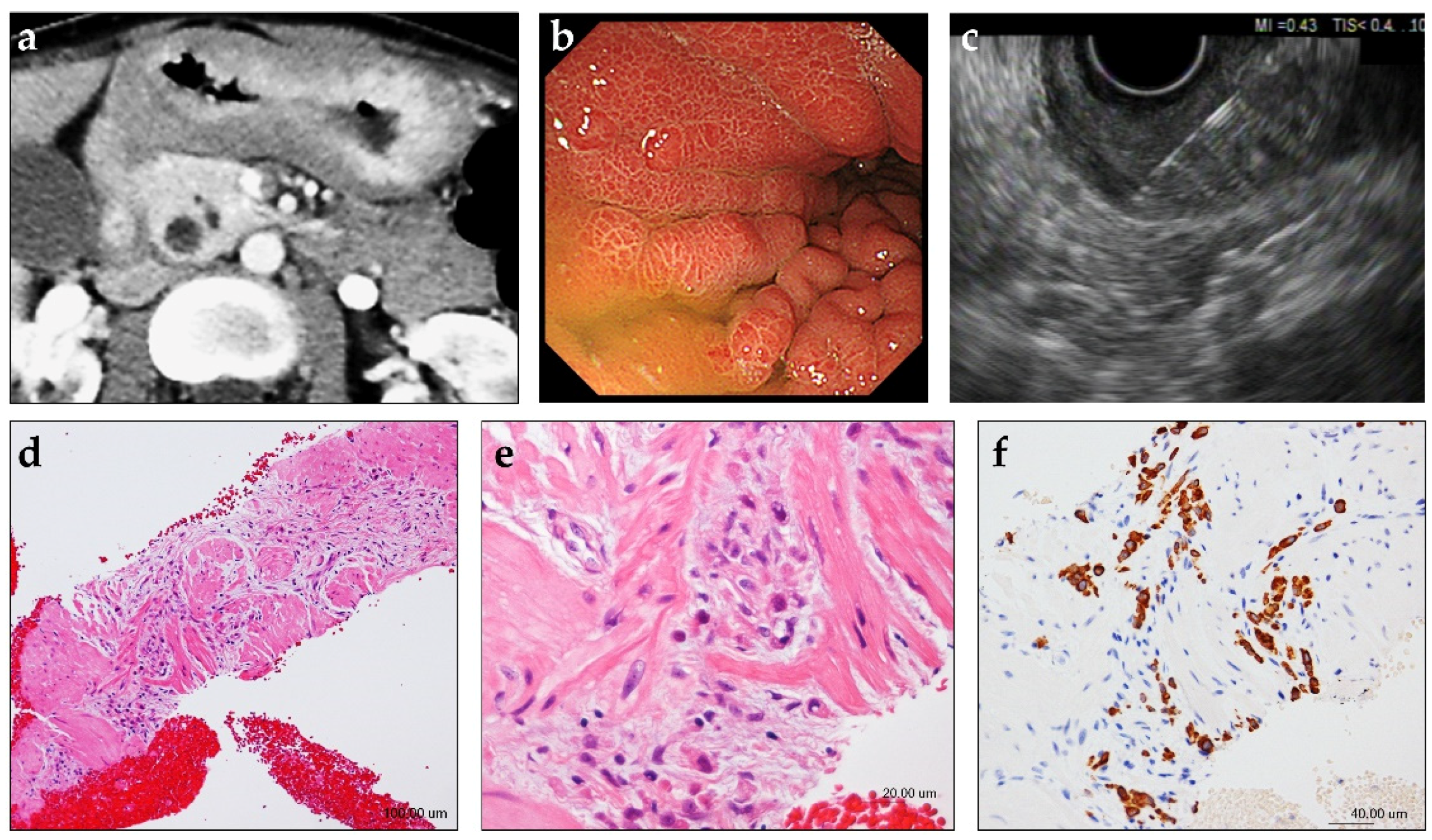 Jcm 10 03716 g002 Jcm 10 03716 g002