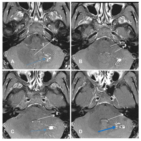 Jcm 10 03899 g002 550