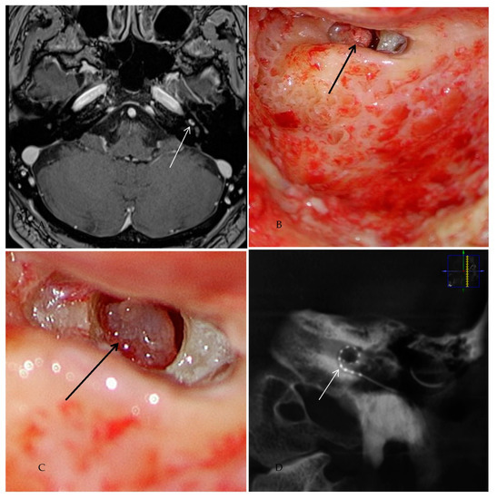 Jcm 10 03899 g003 550