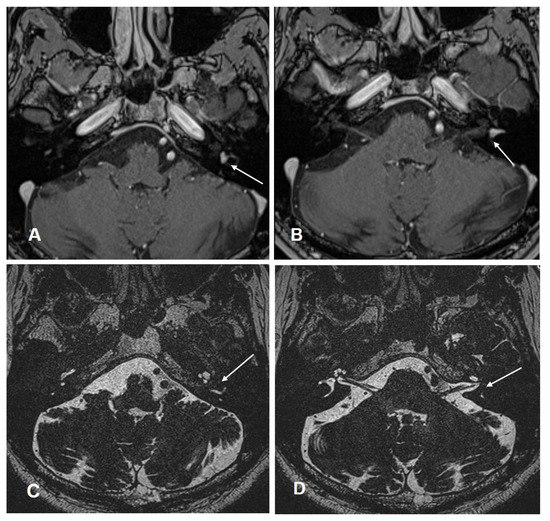 Jcm 10 03899 g005 550