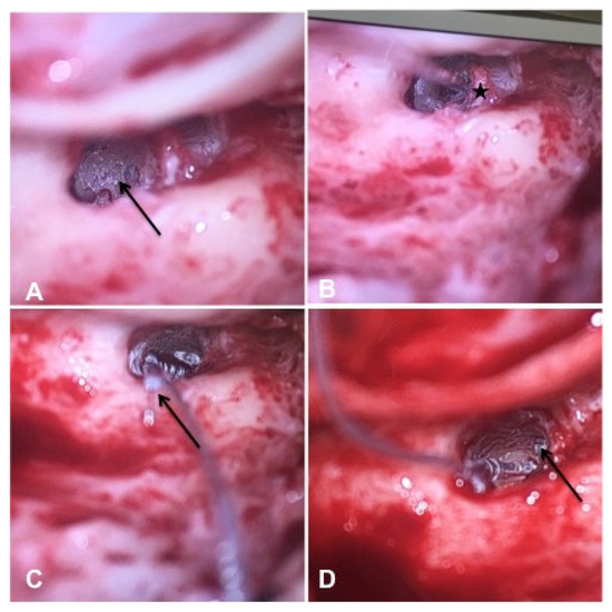 Jcm 10 03899 g006 550