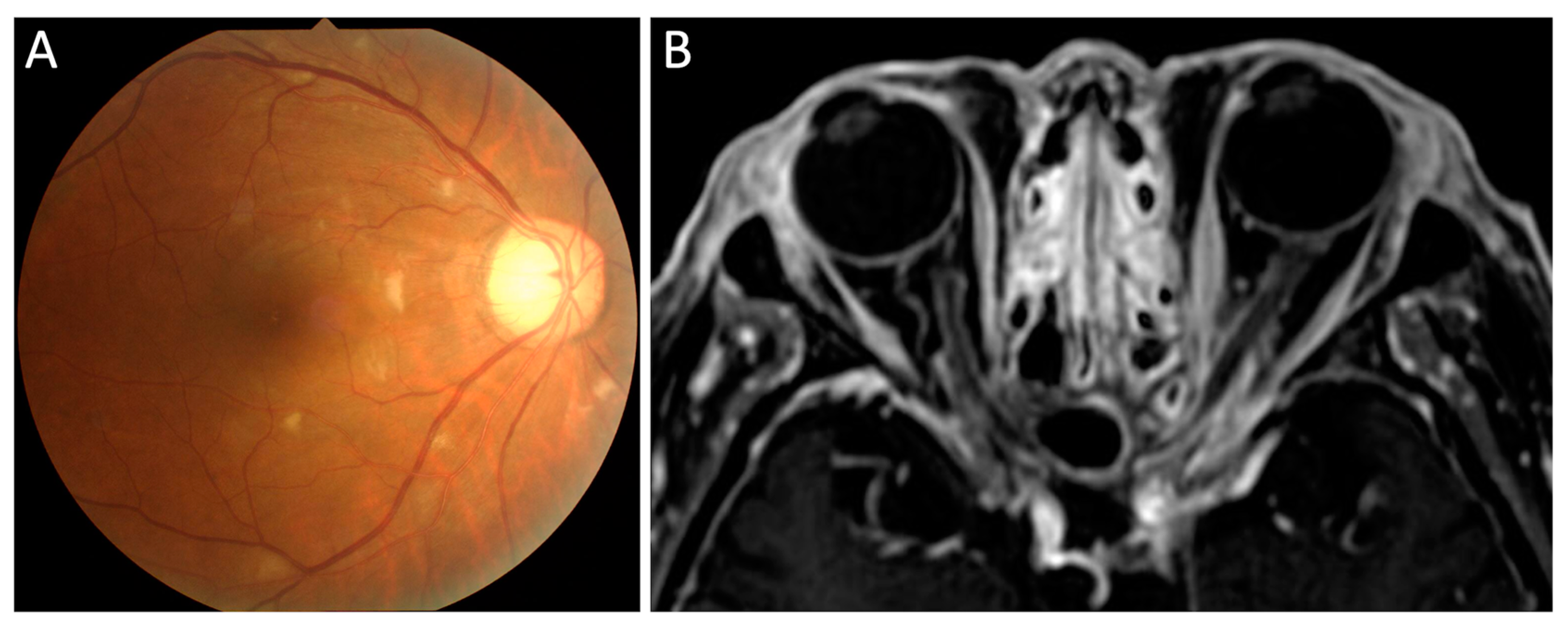 Jcm 10 04970 g005 Jcm 10 04970 g005