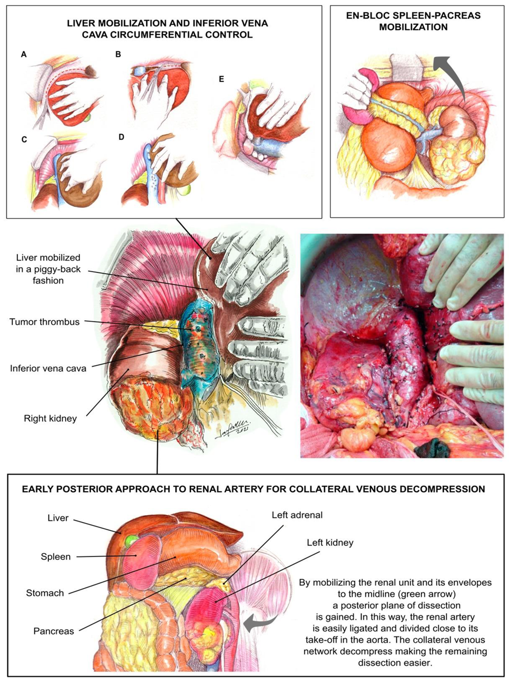 Jcm 10 05964 g002 Jcm 10 05964 g002