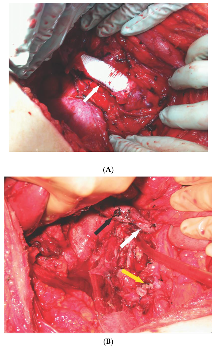 Jcm 10 05964 g003 Jcm 10 05964 g003