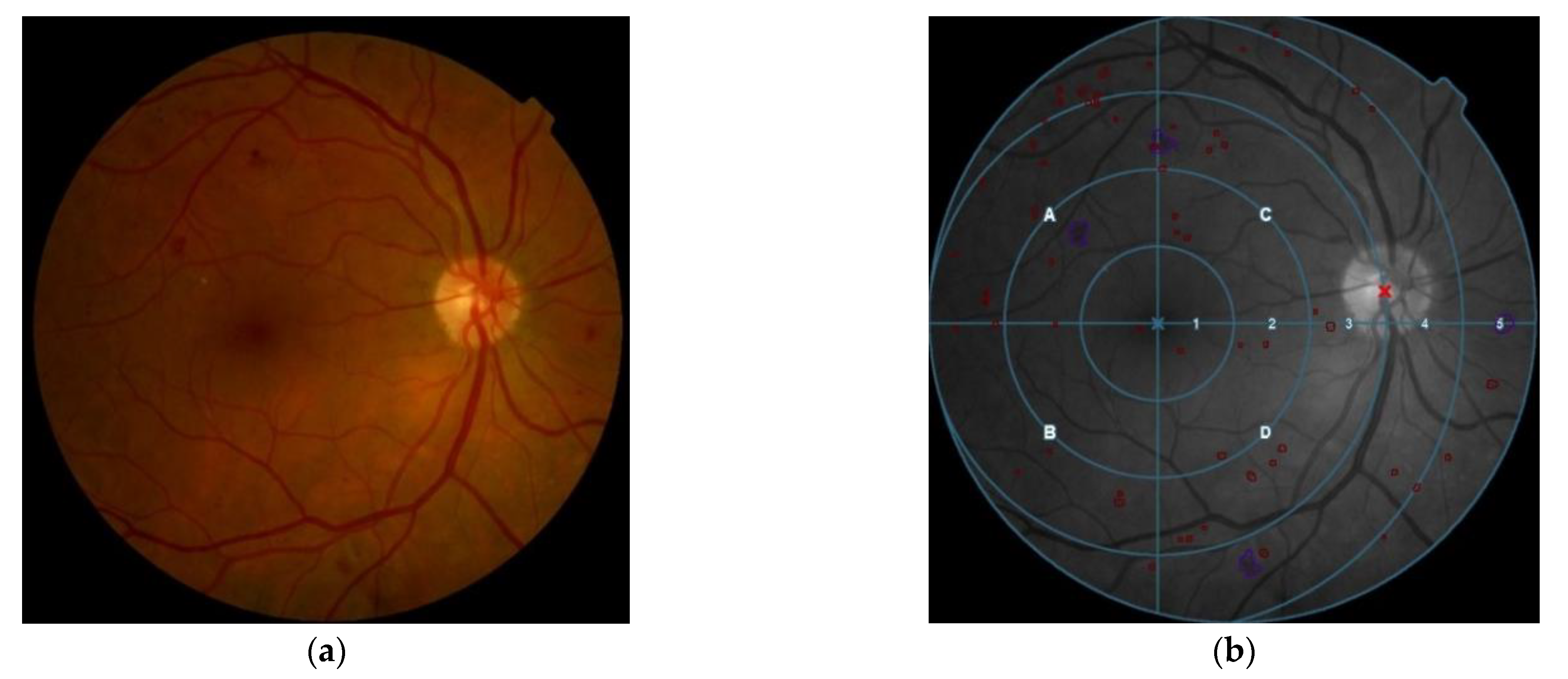 Jcm 11 00014 g001 Jcm 11 00014 g001