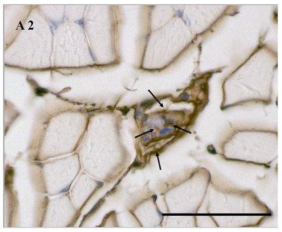 Jcm 11 00086 g0a2 550