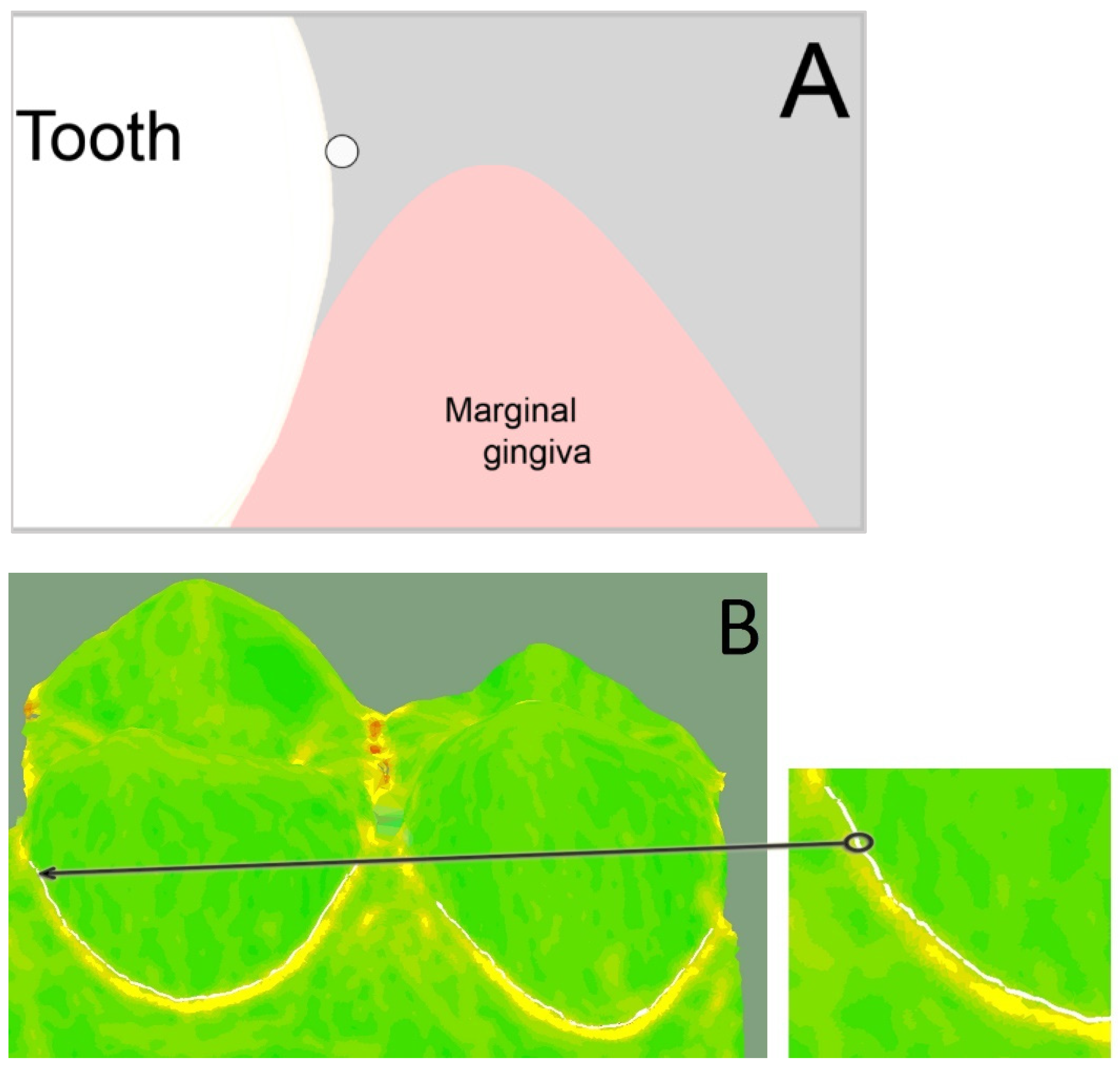 Jcm 11 00437 g003 Jcm 11 00437 g003