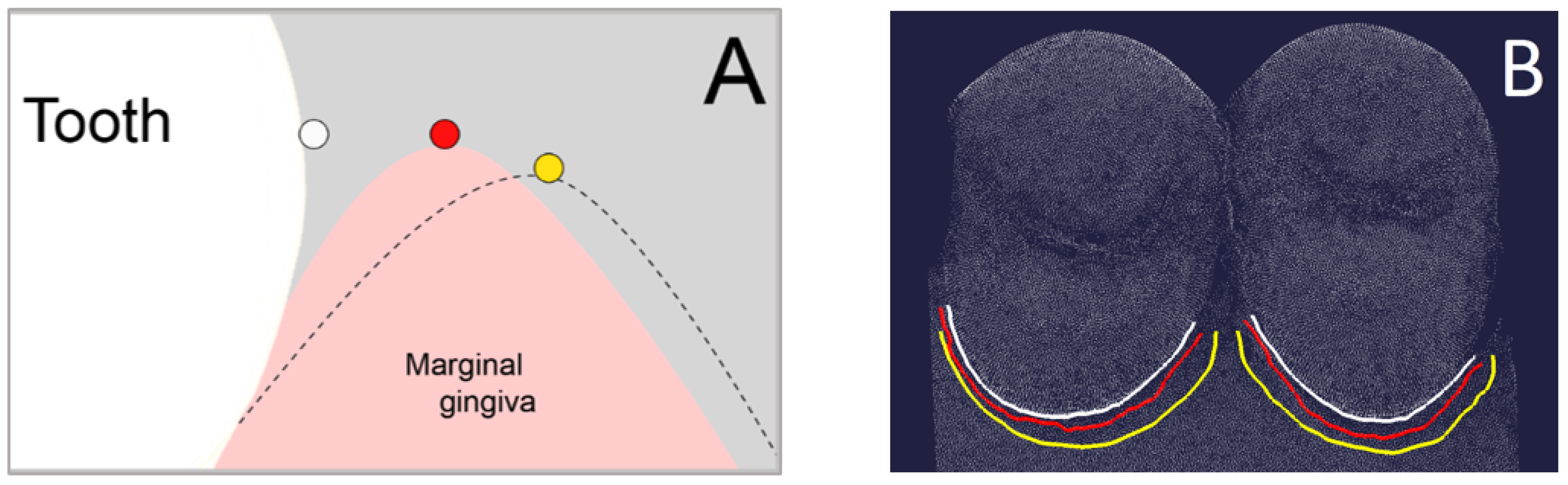 Jcm 11 00437 g005 Jcm 11 00437 g005
