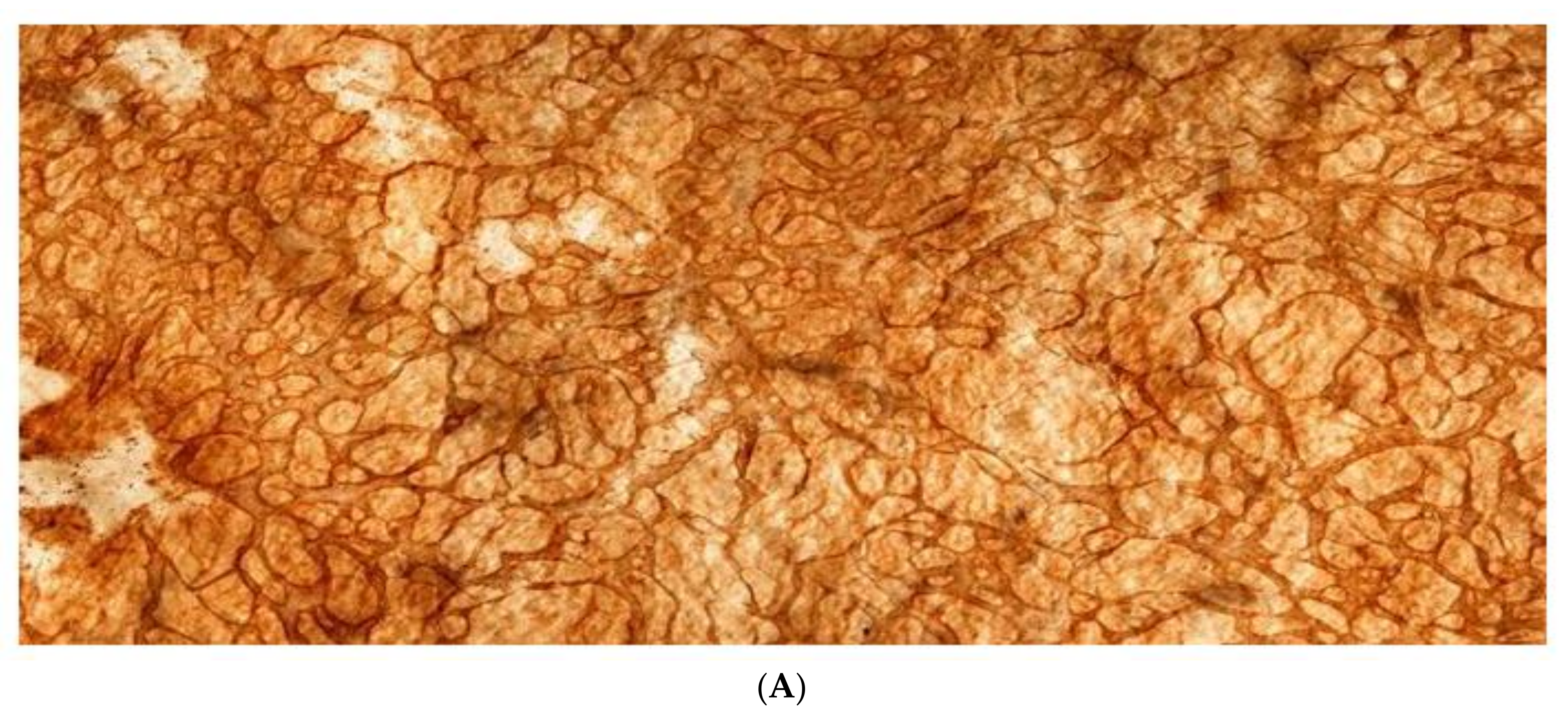 Jcm 11 00458 g004a
