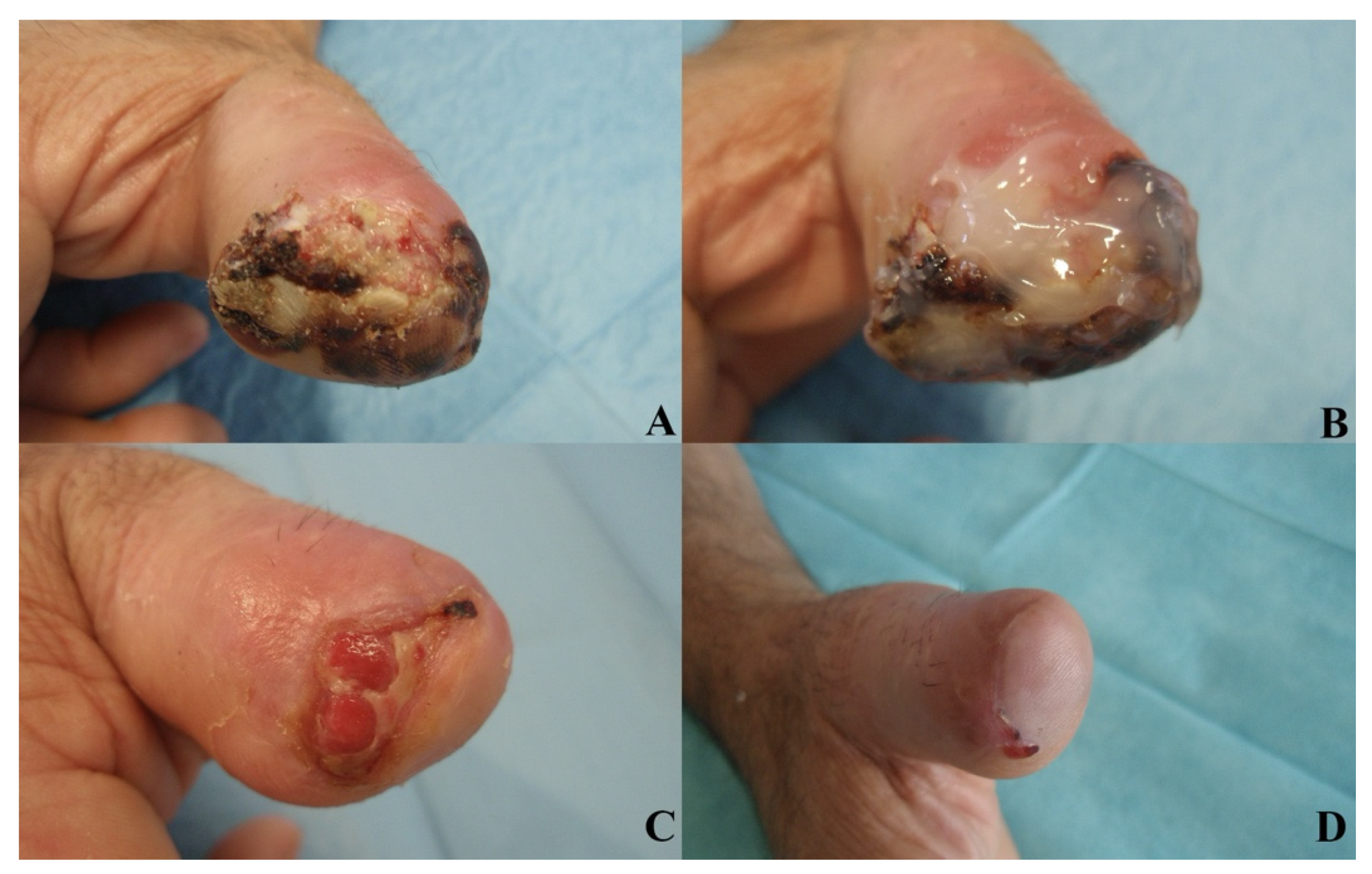 Jcm 11 00537 g005 Jcm 11 00537 g005