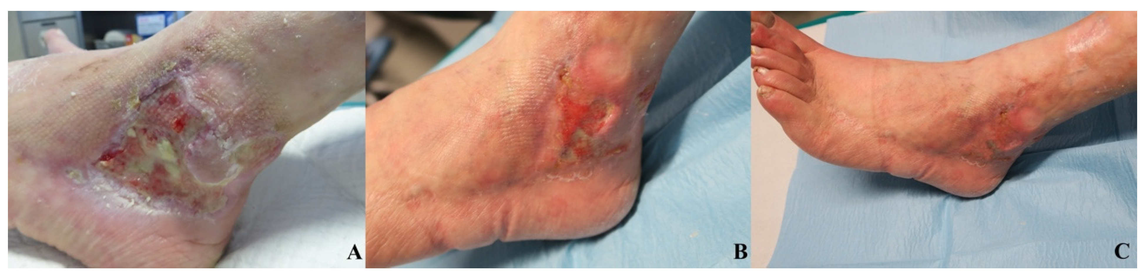 Jcm 11 00537 g006 Jcm 11 00537 g006