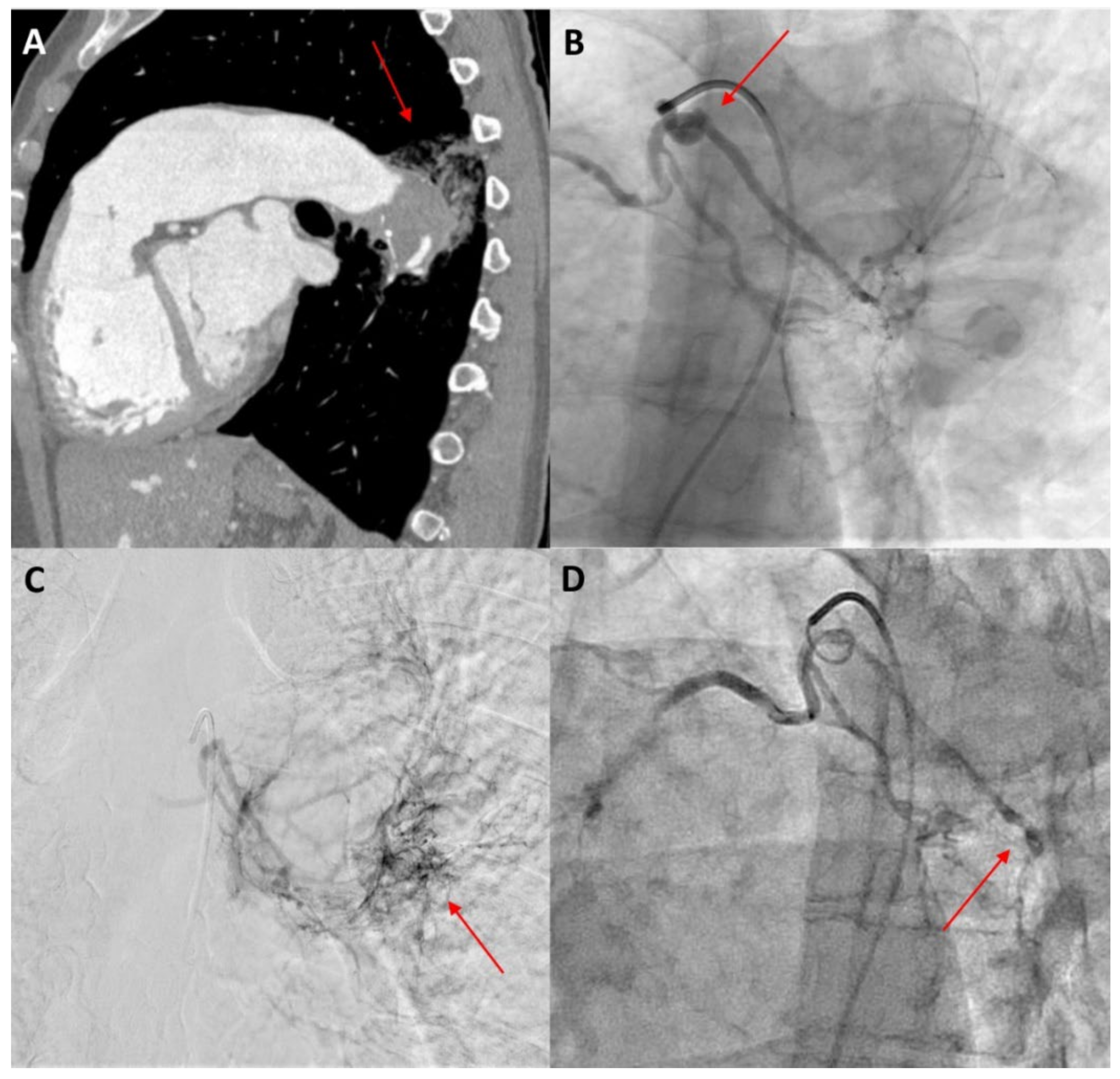 Jcm 11 00633 g003 Jcm 11 00633 g003