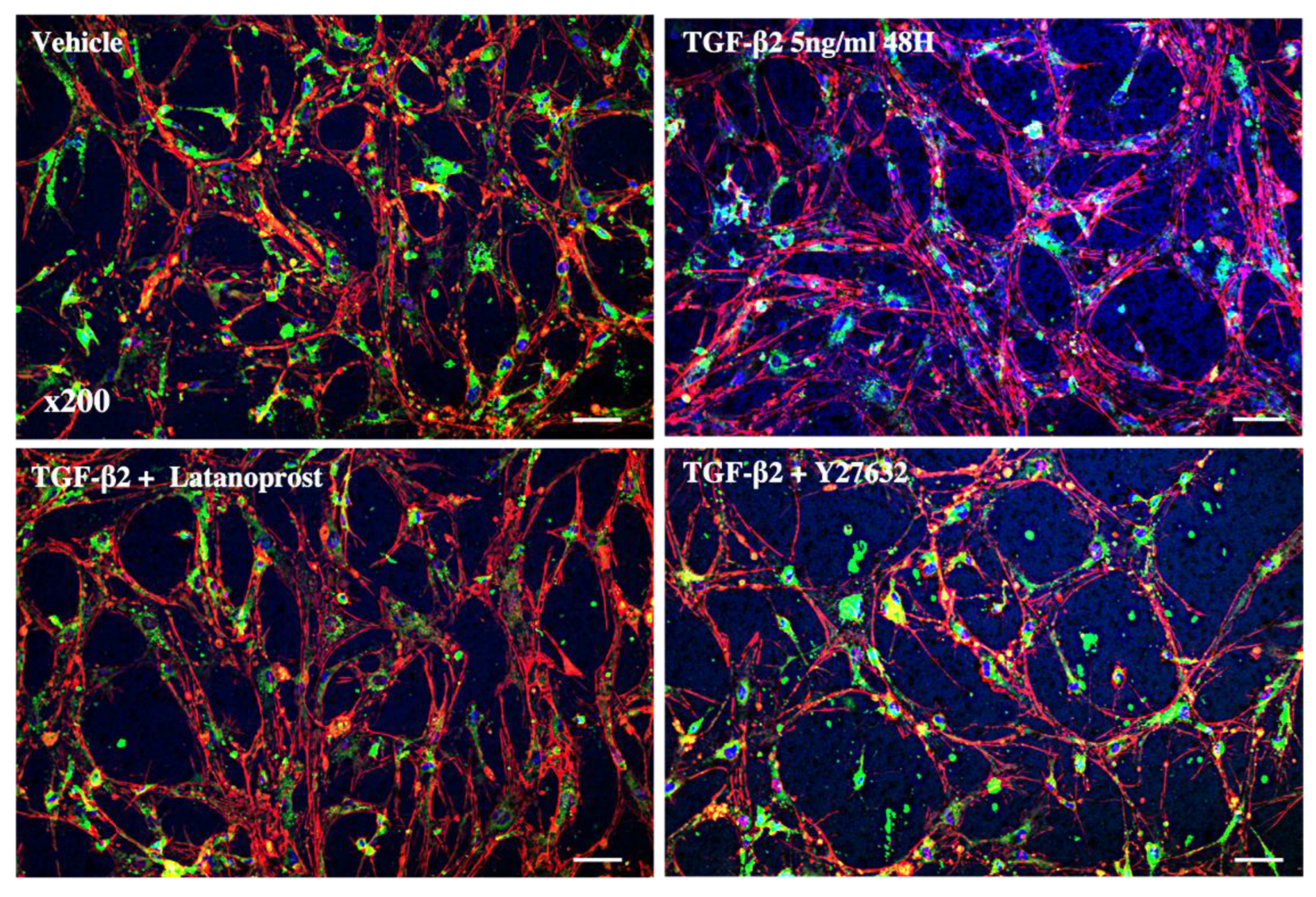 Jcm 11 01001 g005 Jcm 11 01001 g005