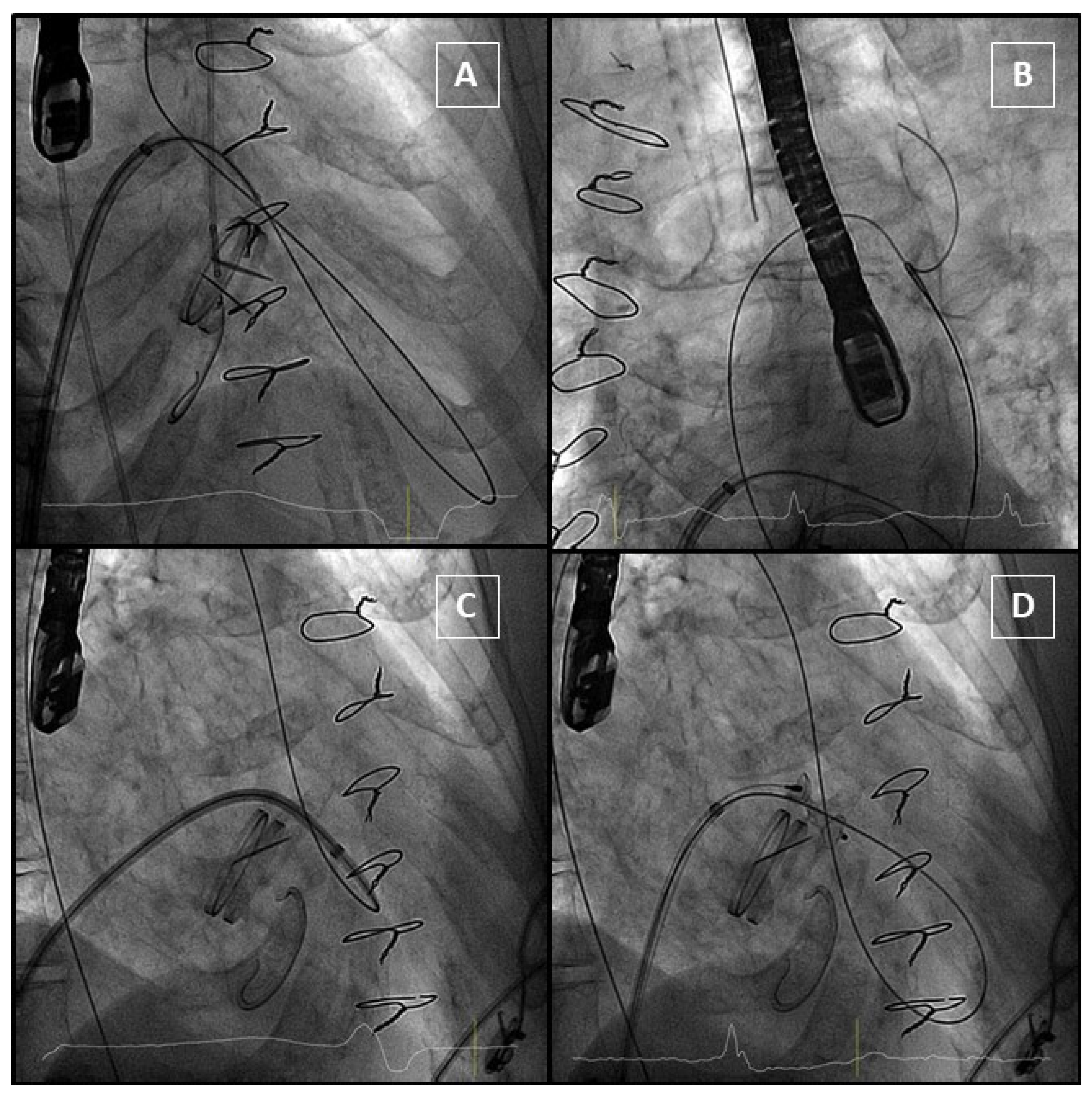 Jcm 11 01245 g008 Jcm 11 01245 g008