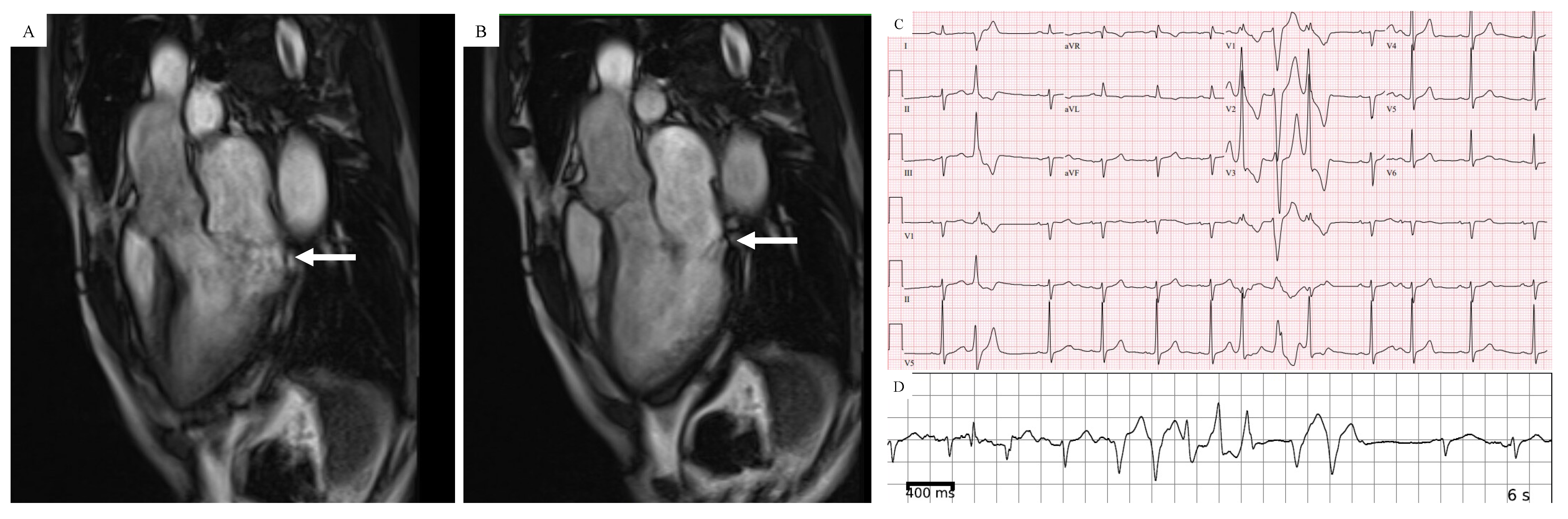 Jcm 11 01285 g004 Jcm 11 01285 g004