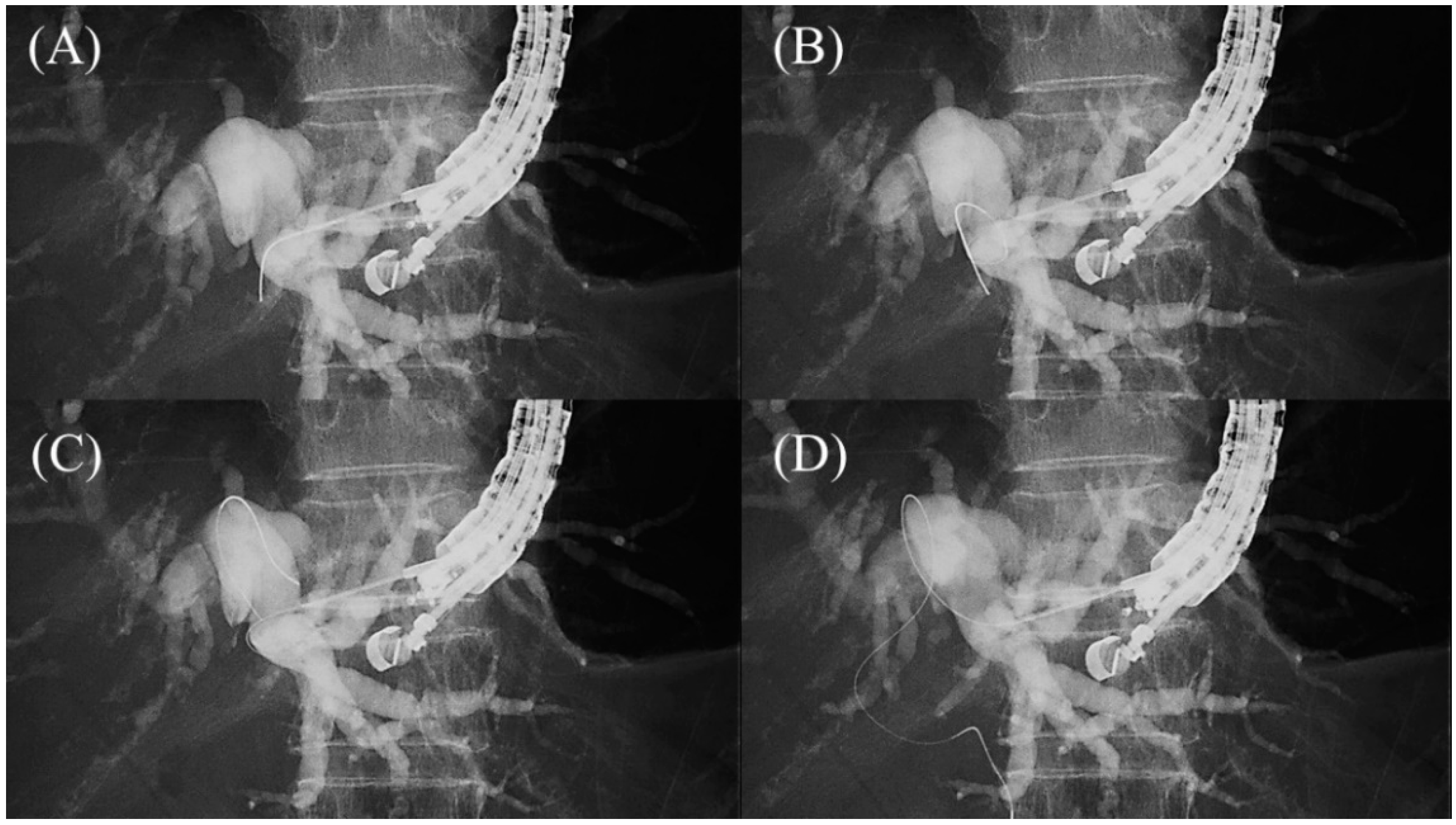 Jcm 11 01591 g010 Jcm 11 01591 g010