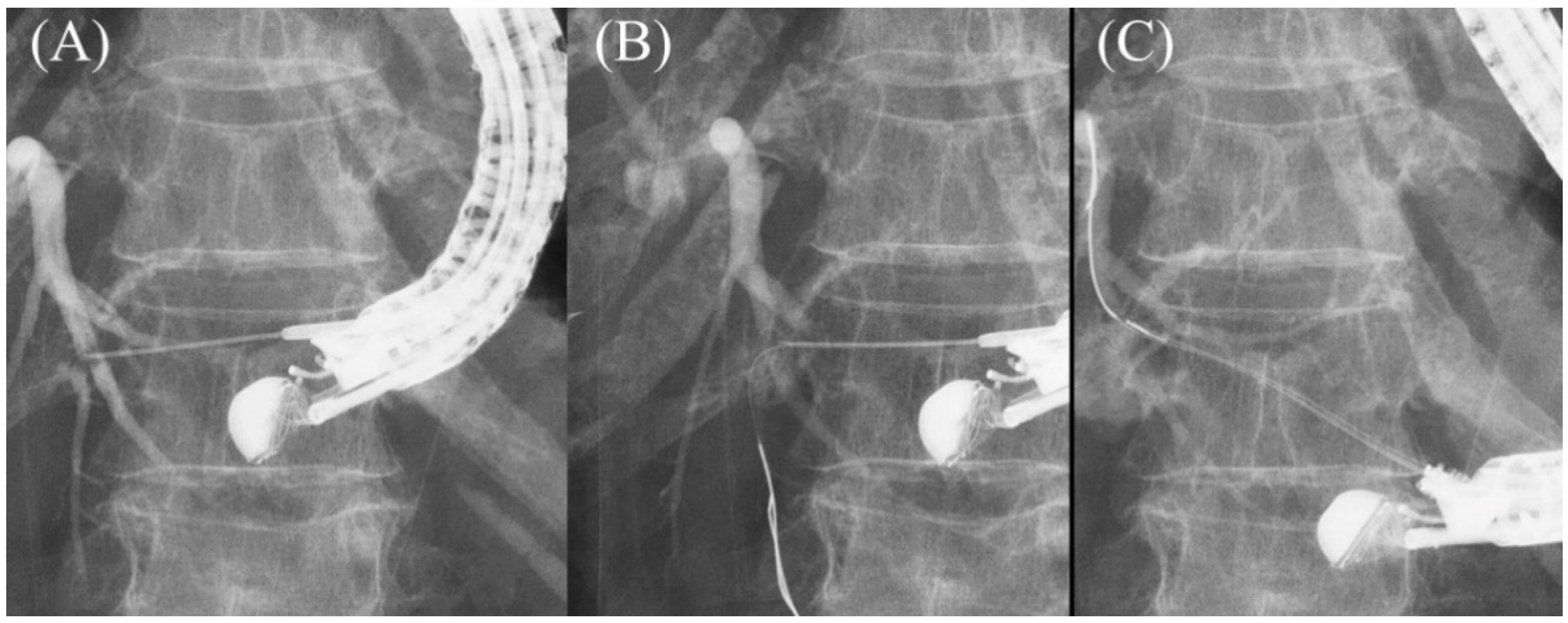 Jcm 11 01591 g011 Jcm 11 01591 g011