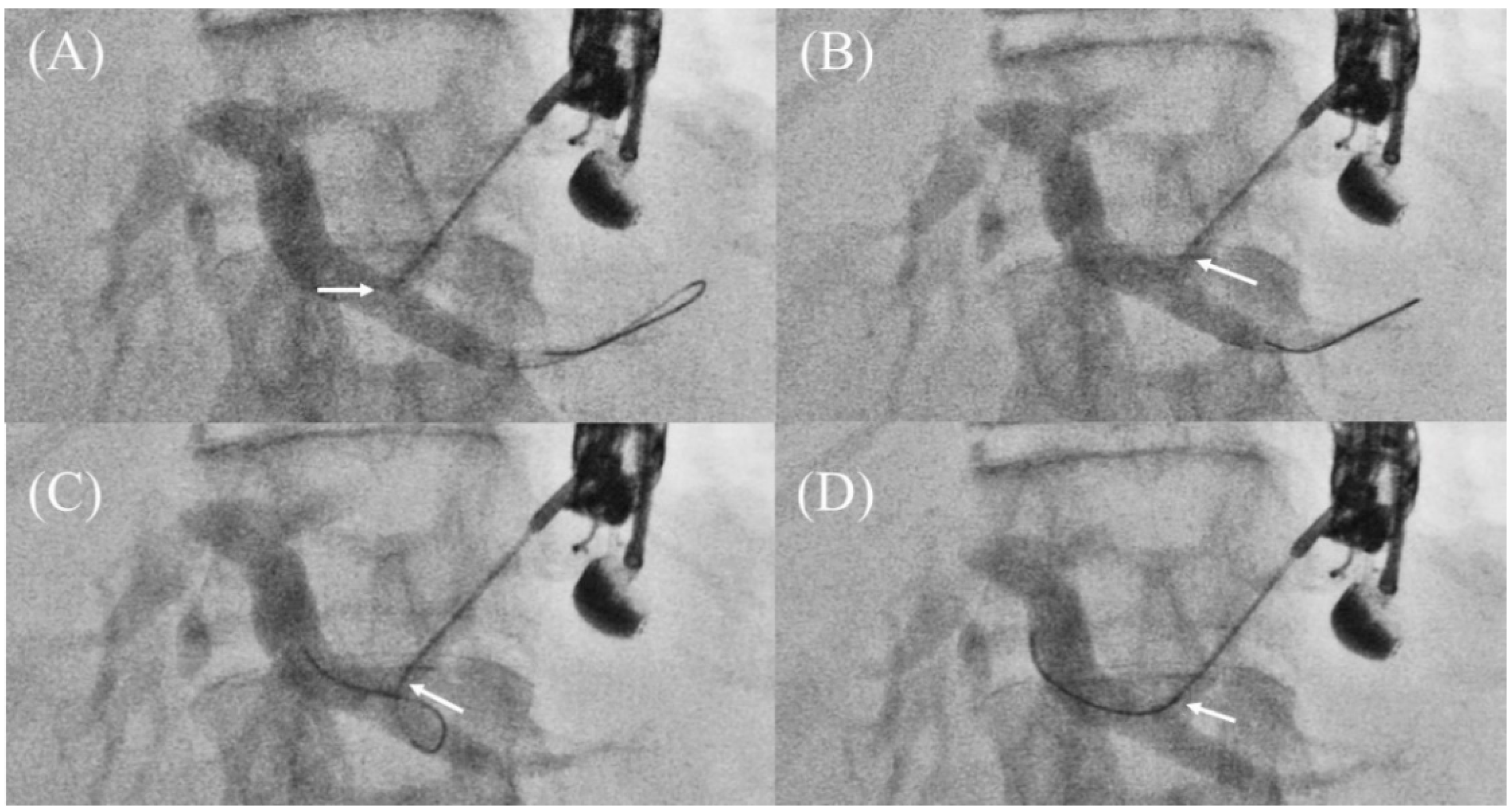 Jcm 11 01591 g012 Jcm 11 01591 g012